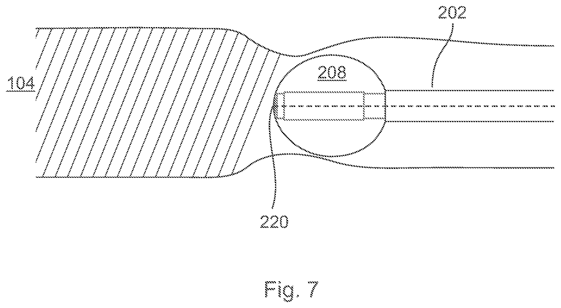Patent US12496089 Figure 7 – Vessel blockage passing