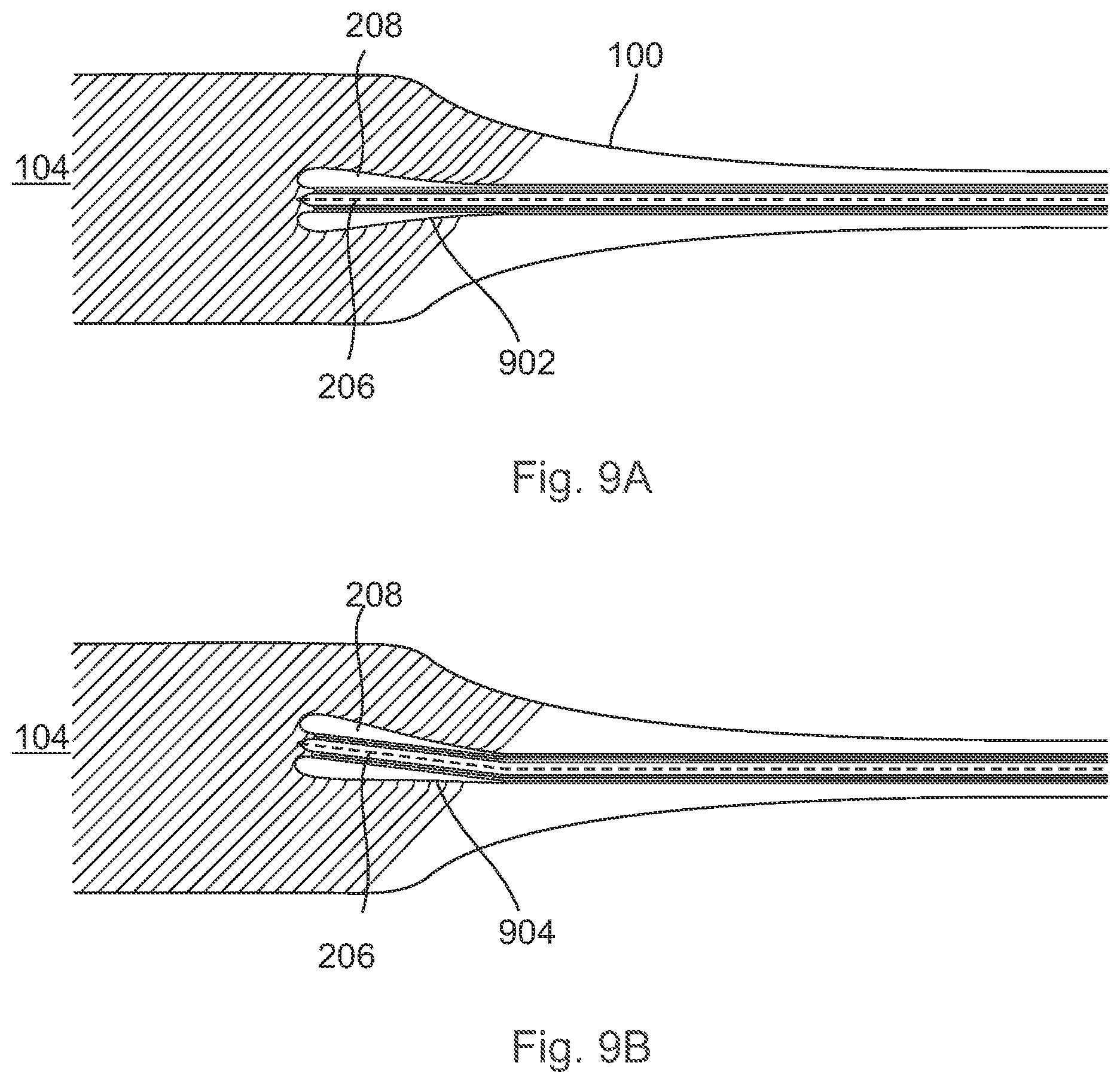 Patent US12496089 Figure 9 – Vessel blockage passing