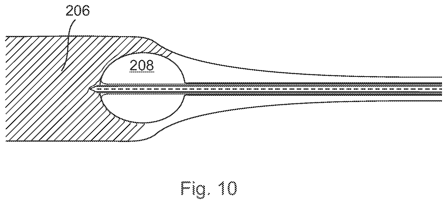Patent US12496089 Figure 10 – Vessel blockage passing