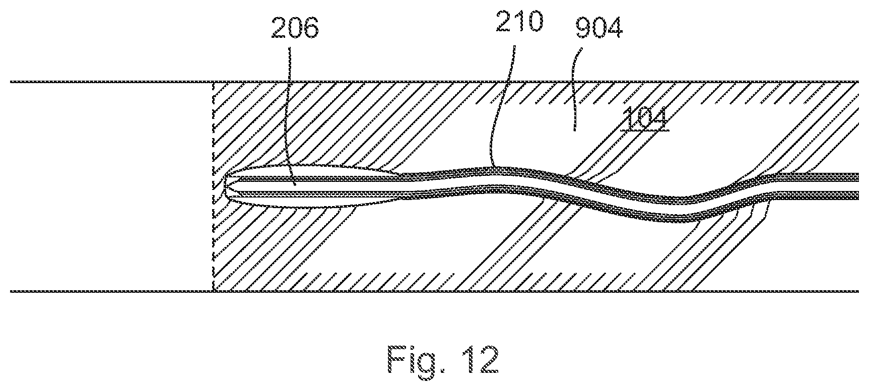 Patent US12496089 Figure 12 – Vessel blockage passing