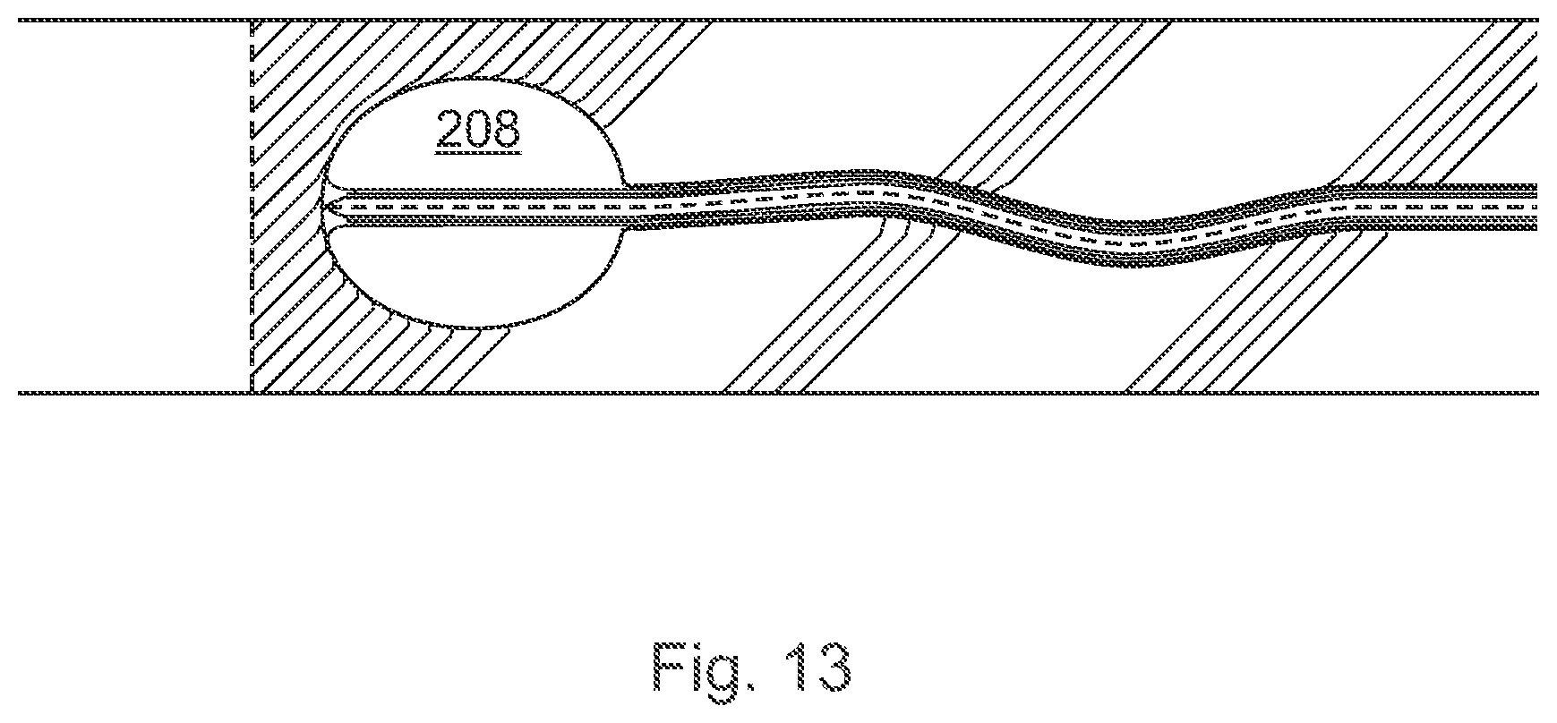 Patent US12496089 Figure 13 – Vessel blockage passing