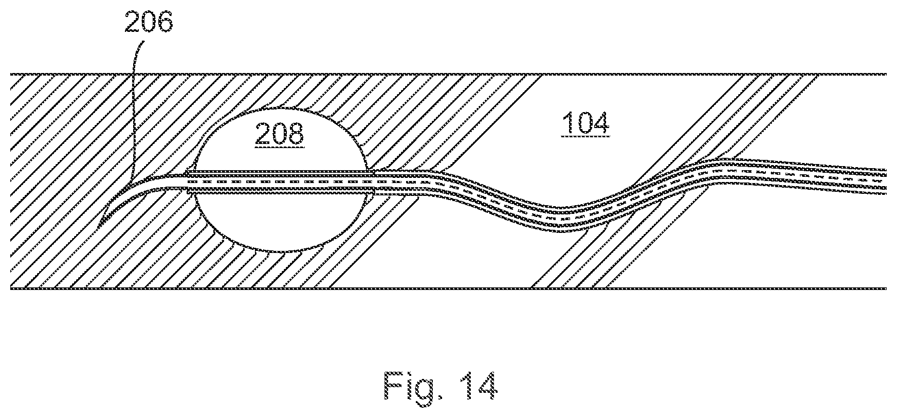 Patent US12496089 Figure 14 – Vessel blockage passing