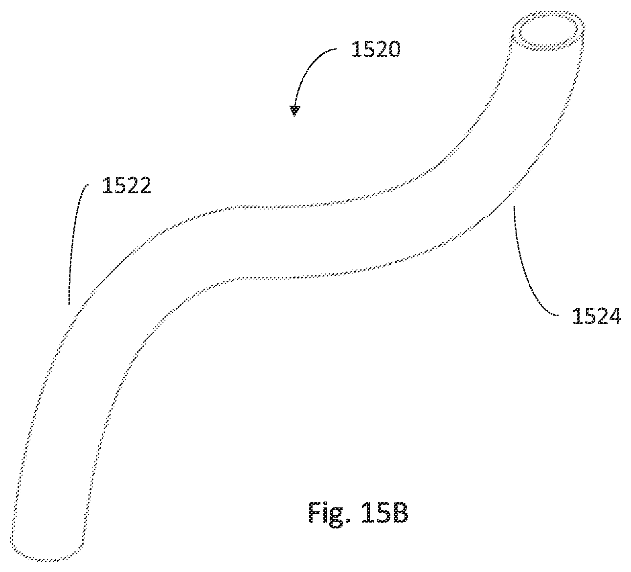 Patent US12496089 Figure 16 – Vessel blockage passing
