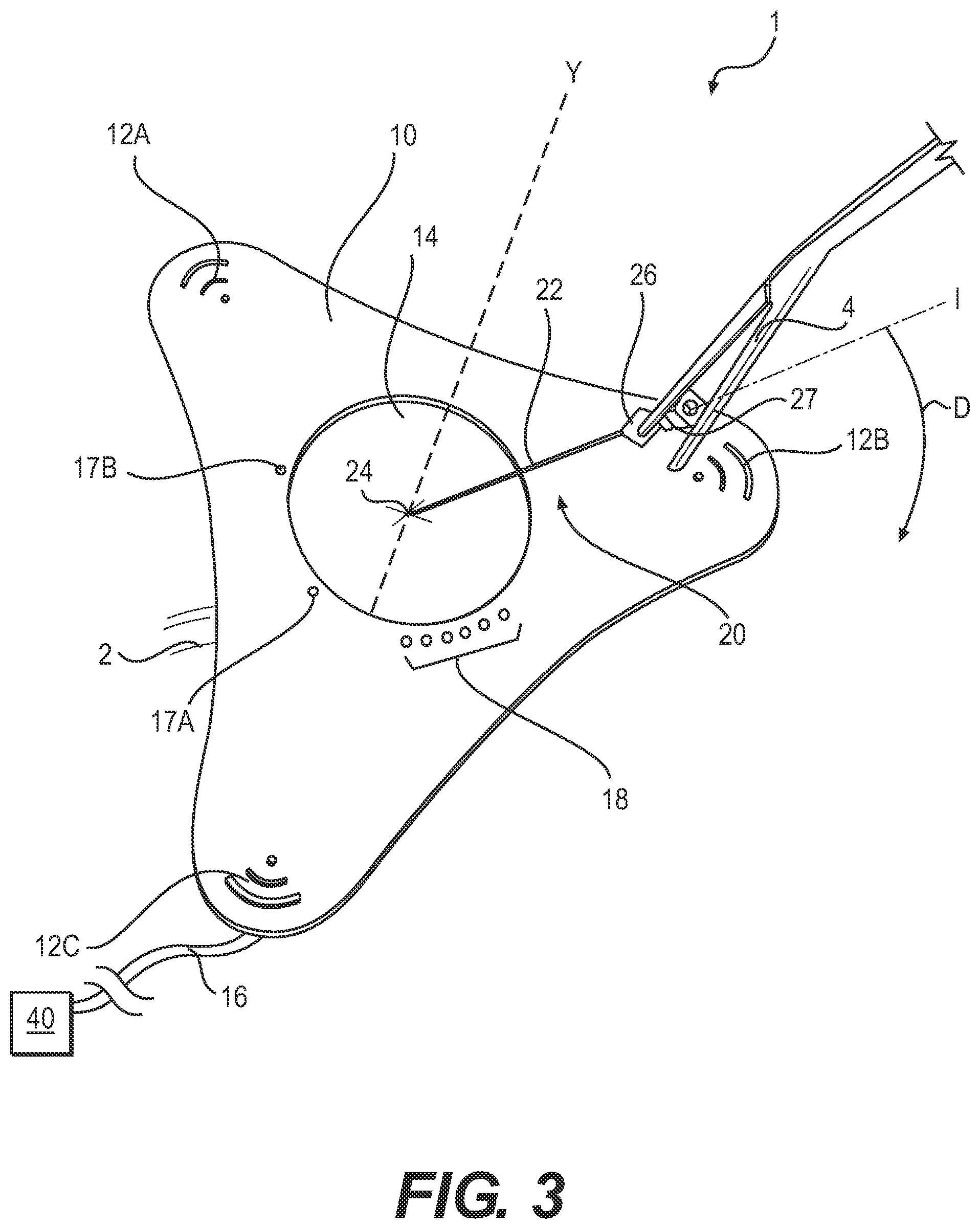 Patent US12496092 Figure 3 – Surgical guidance devices, systems, and methods