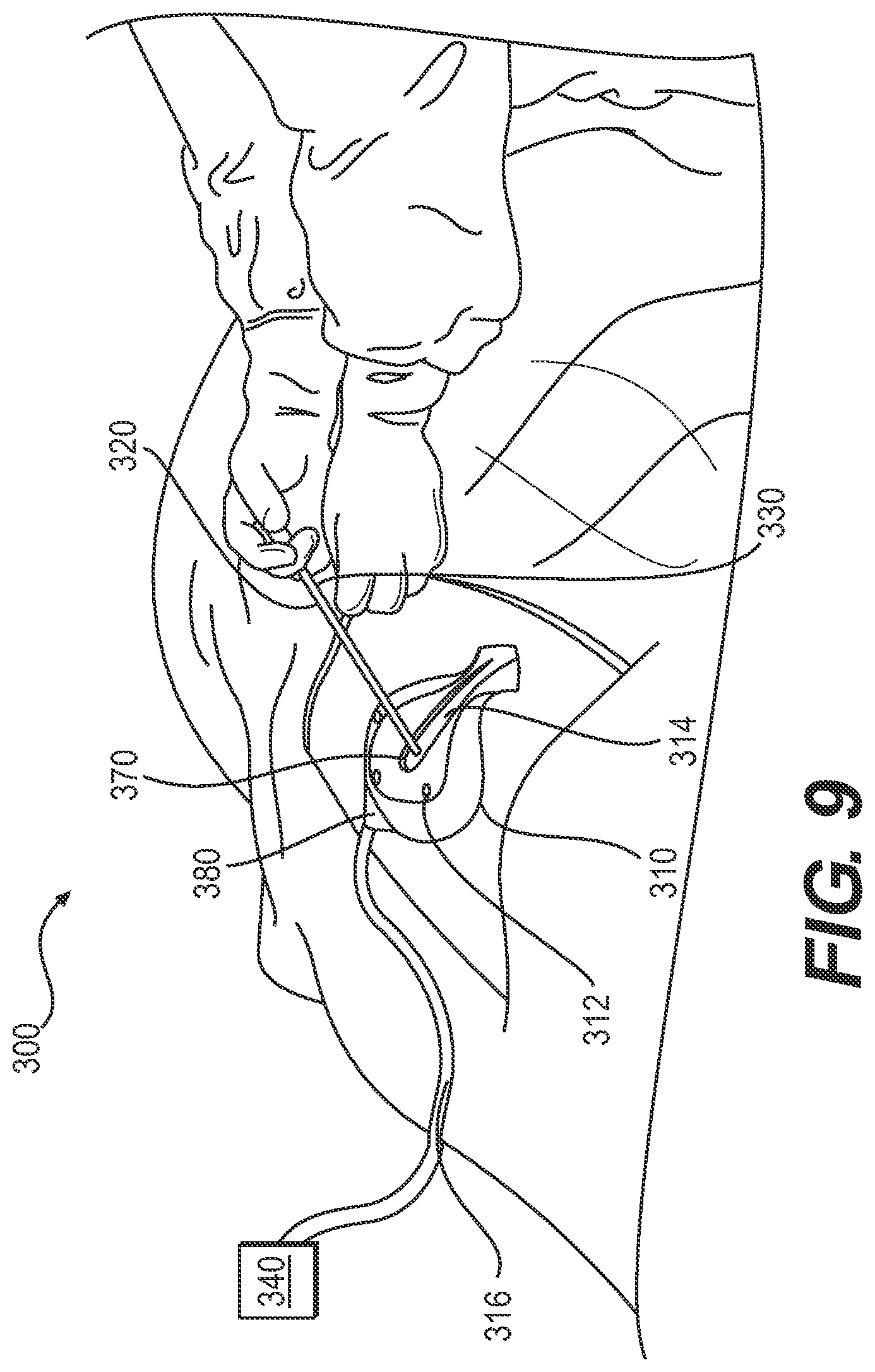 Patent US12496092 Figure 9 – Surgical guidance devices, systems, and methods