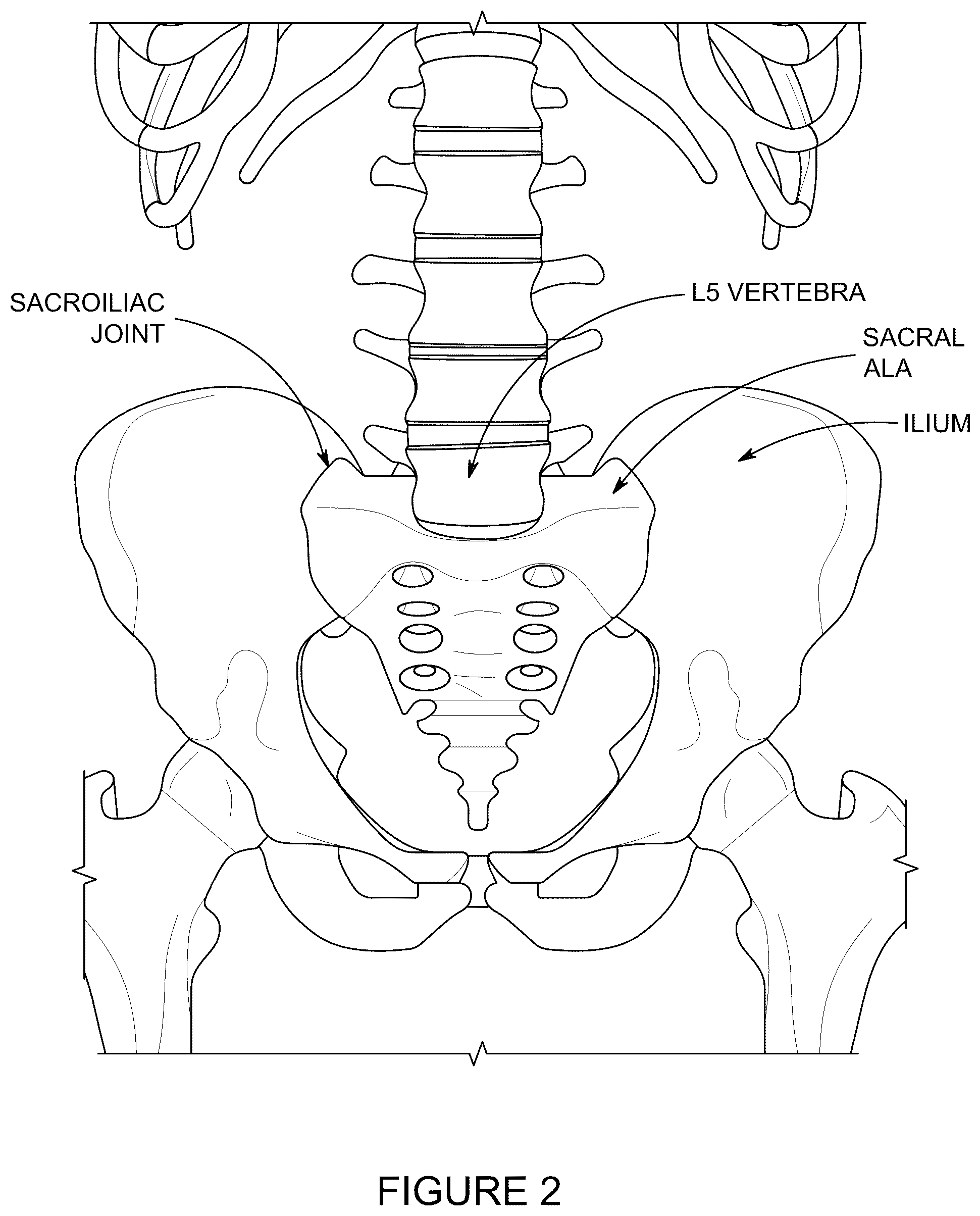 Patent US12496094 Figure 2 – Methods of detecting and treating back pain