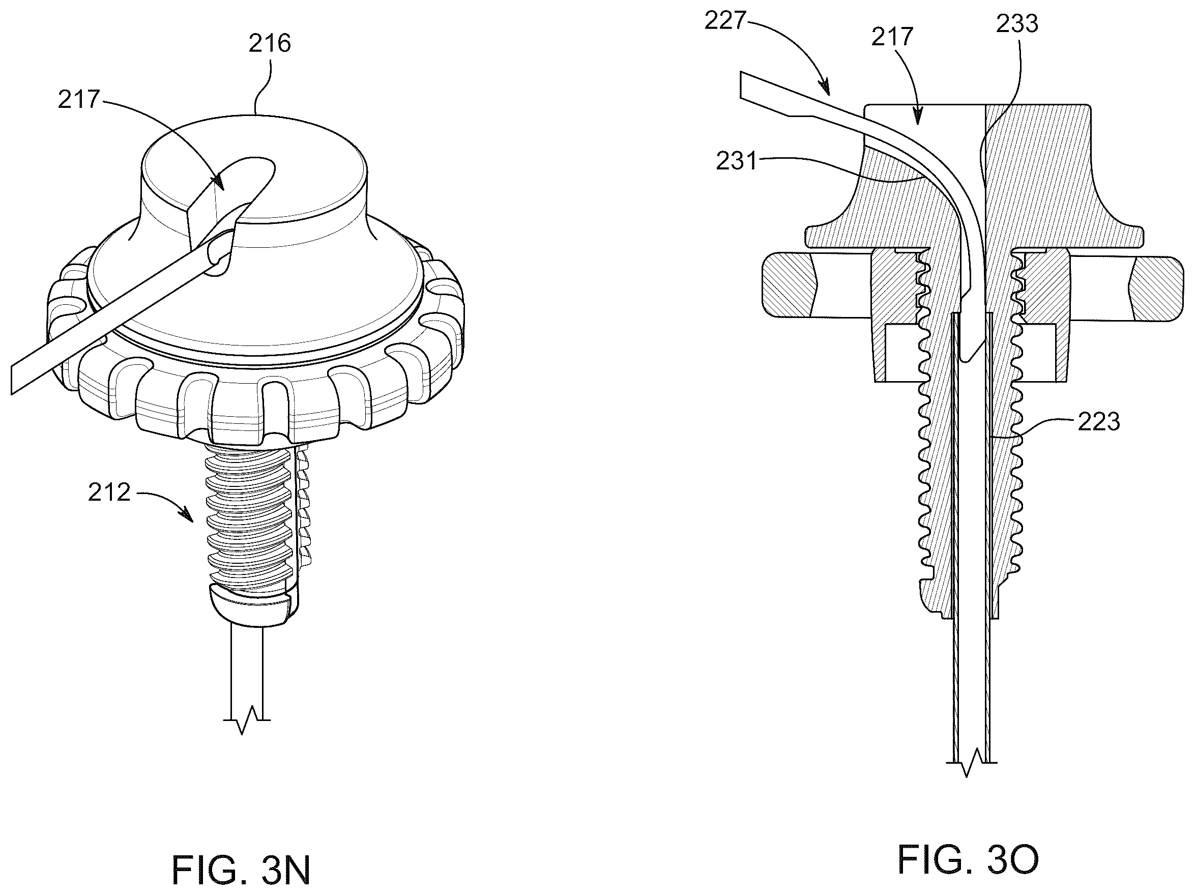 Patent US12496094 Figure 11 – Methods of detecting and treating back pain