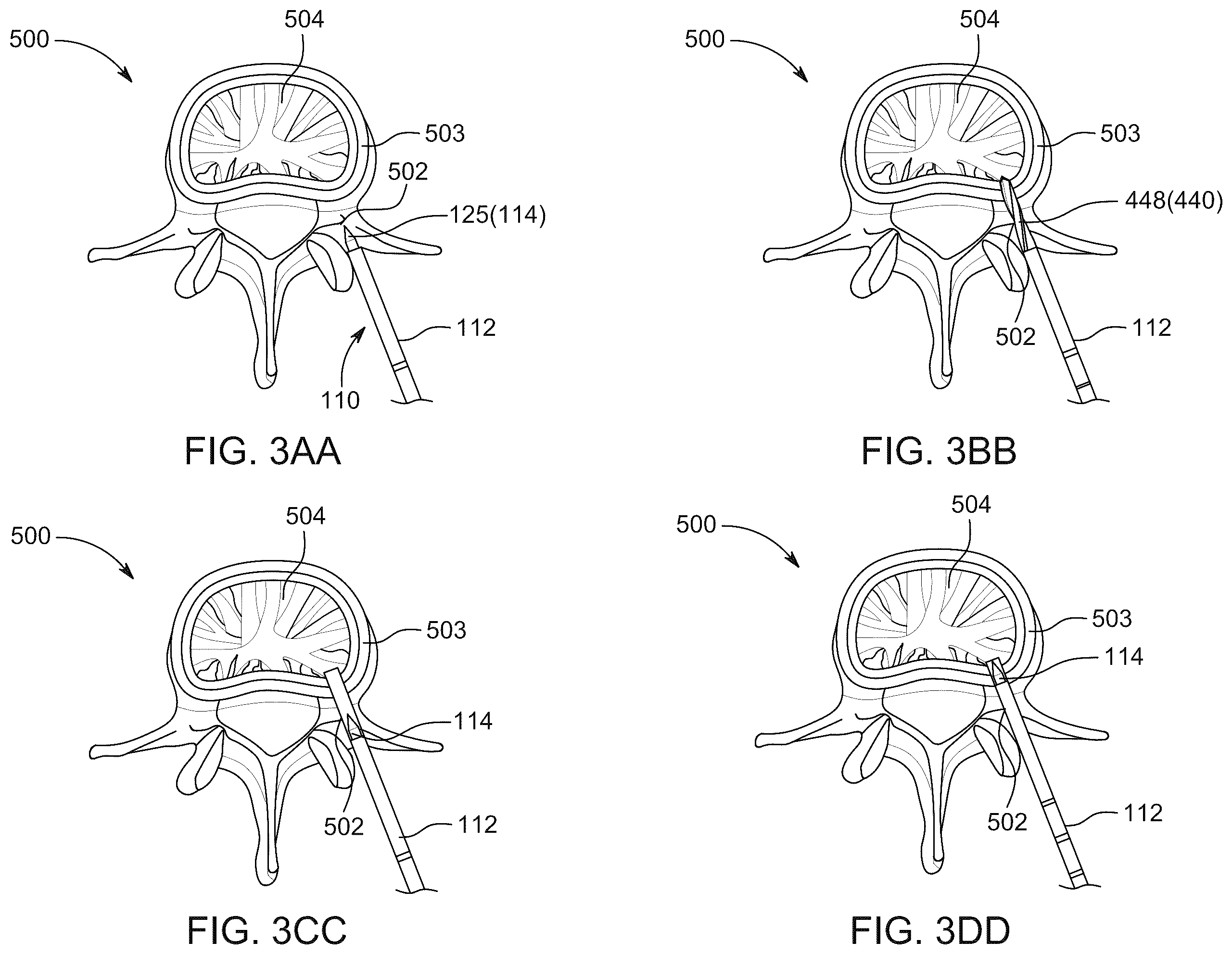 Patent US12496094 Figure 19 – Methods of detecting and treating back pain