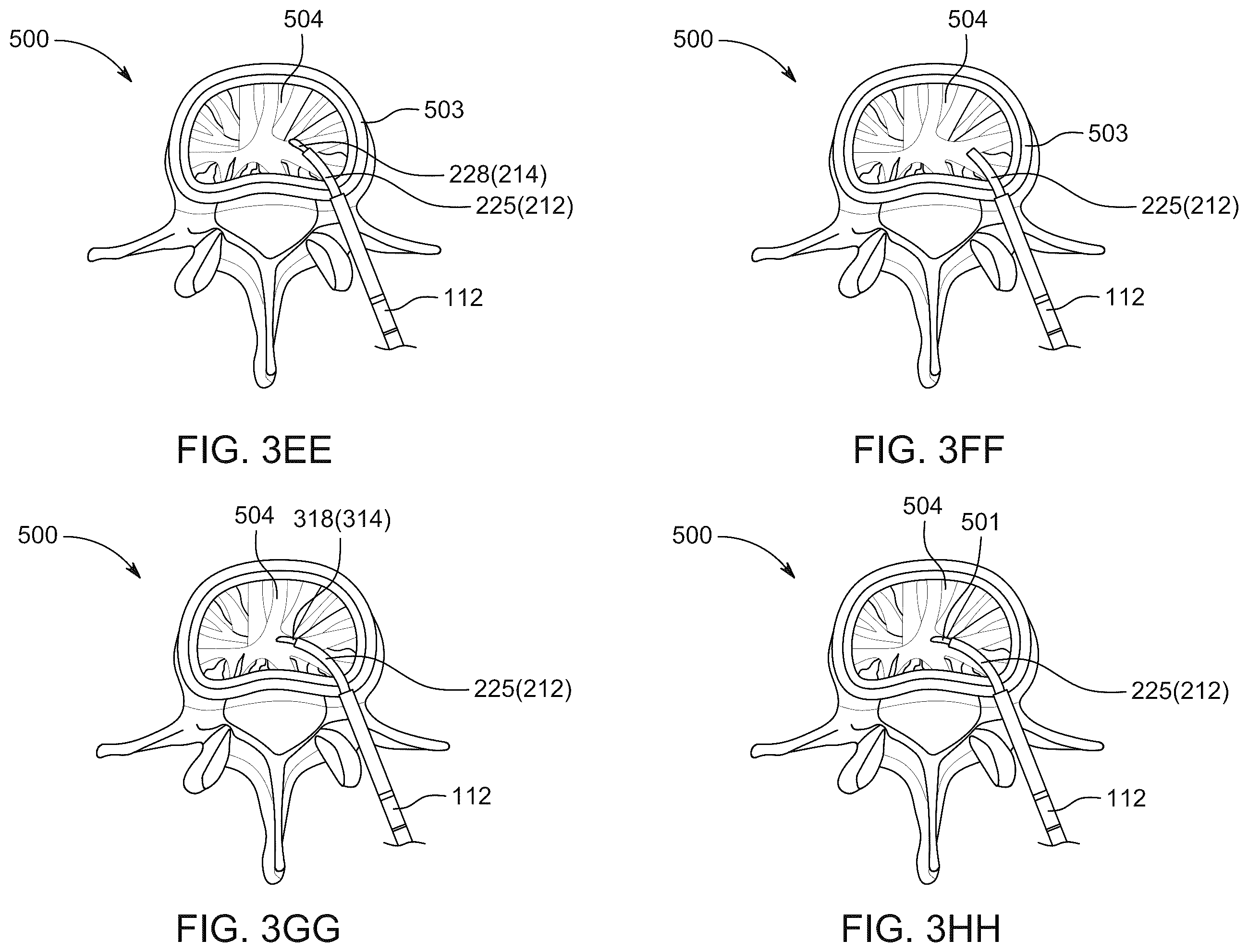 Patent US12496094 Figure 20 – Methods of detecting and treating back pain