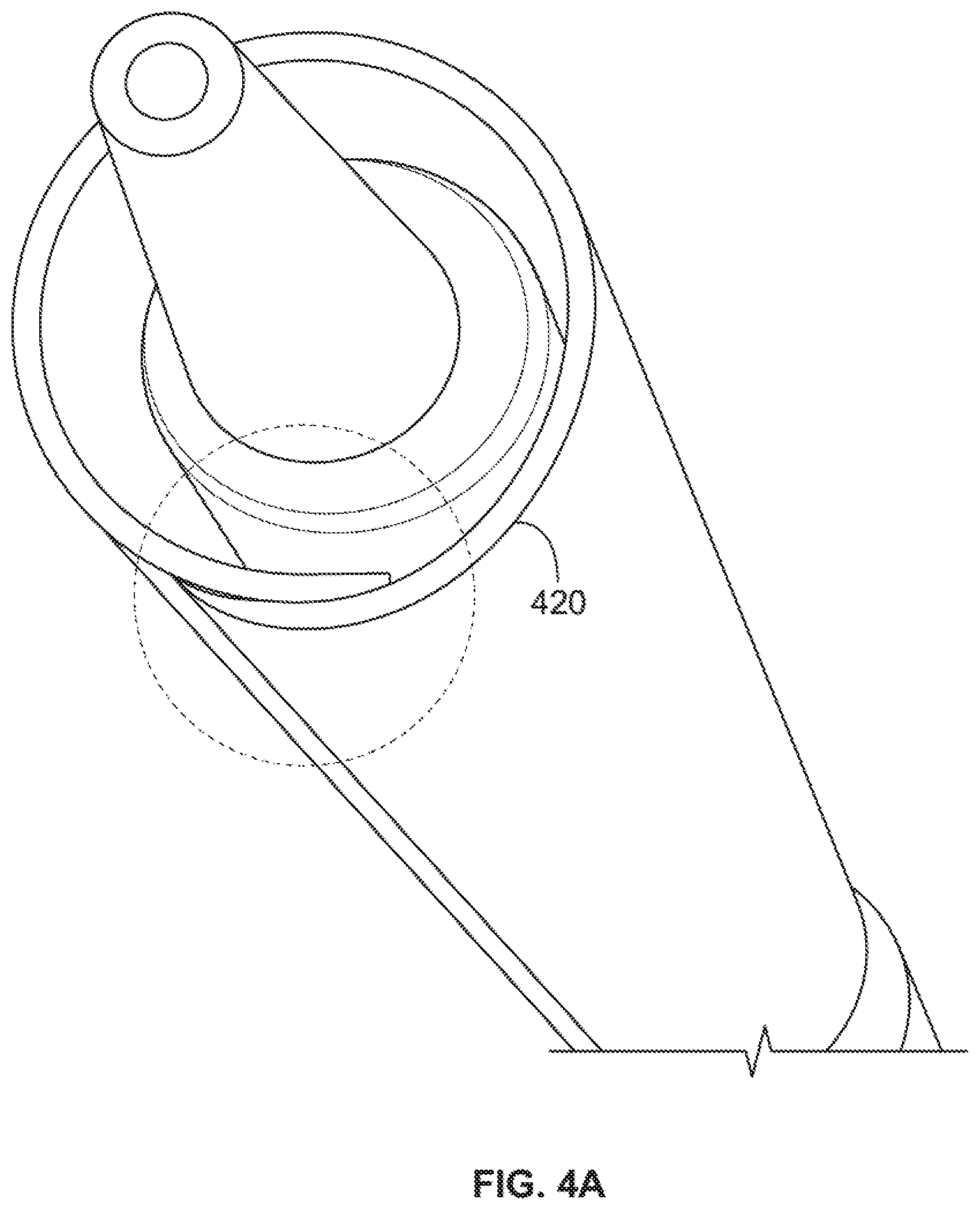 Patent US12496095 Figure 3 – Integrated expandable access for medical device introducer