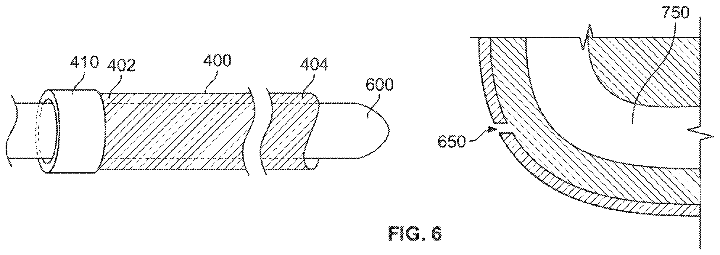 Patent US12496095 Figure 5 – Integrated expandable access for medical device introducer