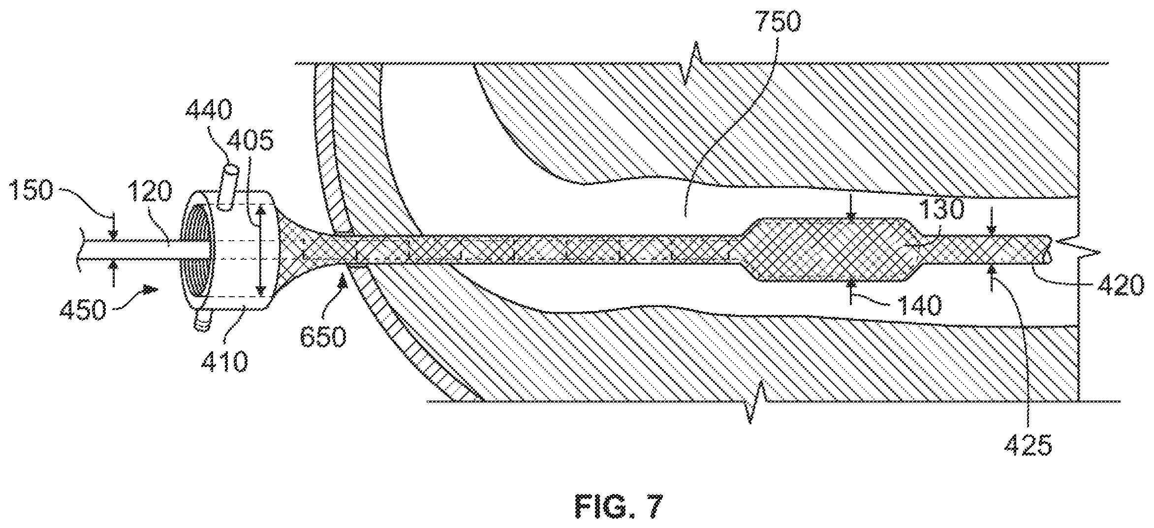 Patent US12496095 Figure 6 – Integrated expandable access for medical device introducer