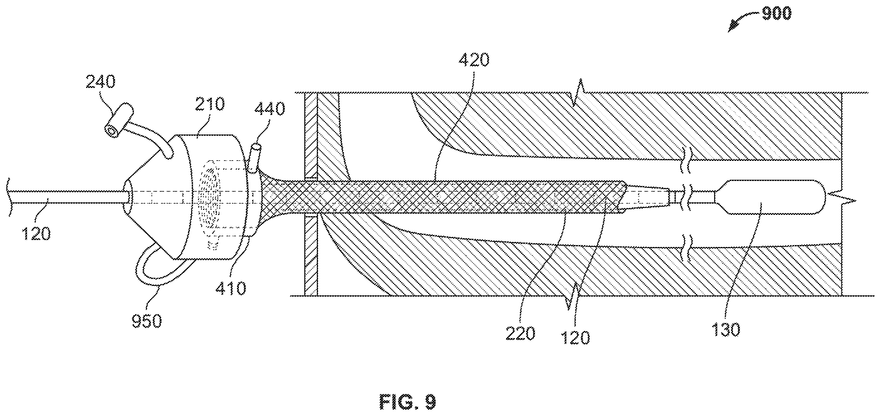 Patent US12496095 Figure 8 – Integrated expandable access for medical device introducer