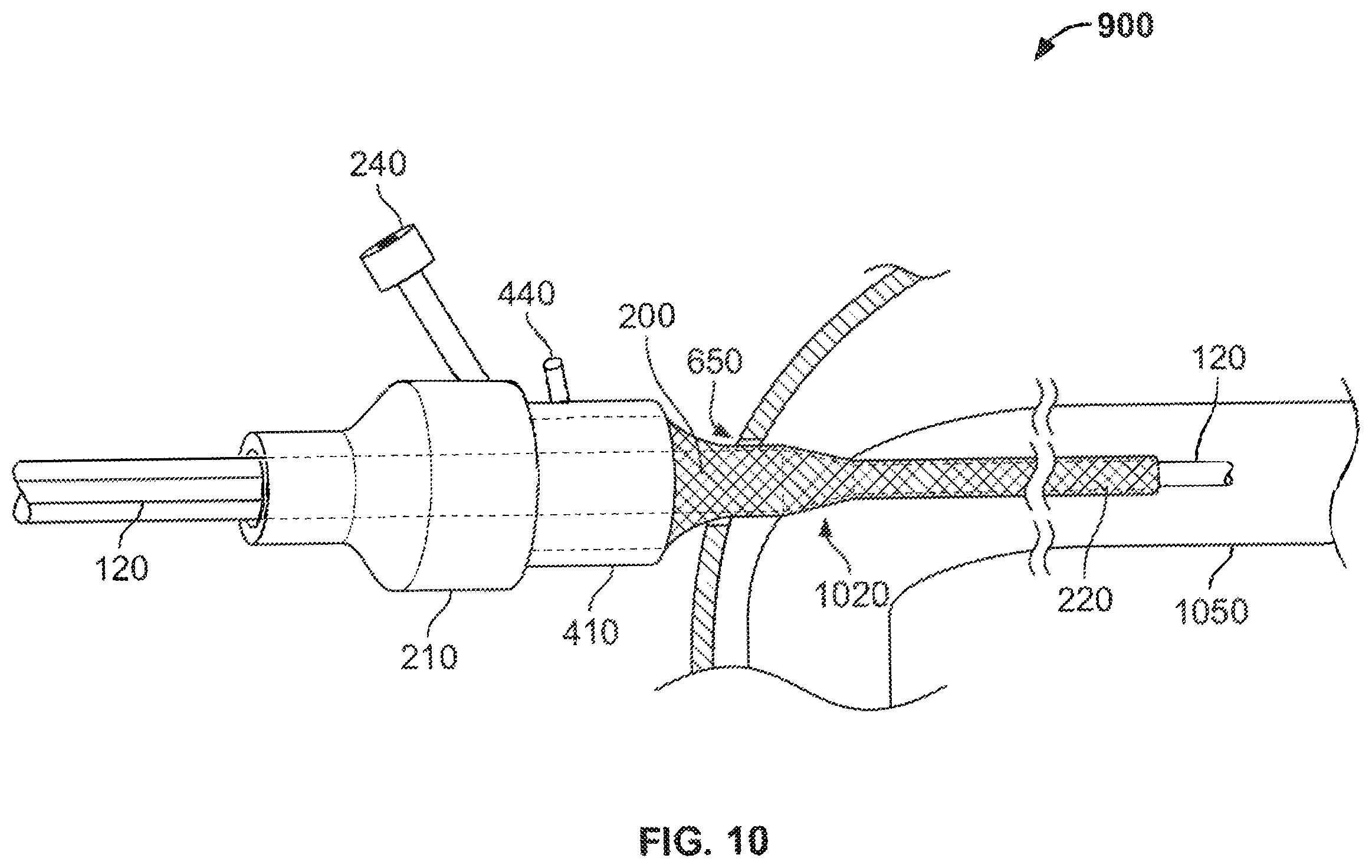 Patent US12496095 Figure 9 – Integrated expandable access for medical device introducer
