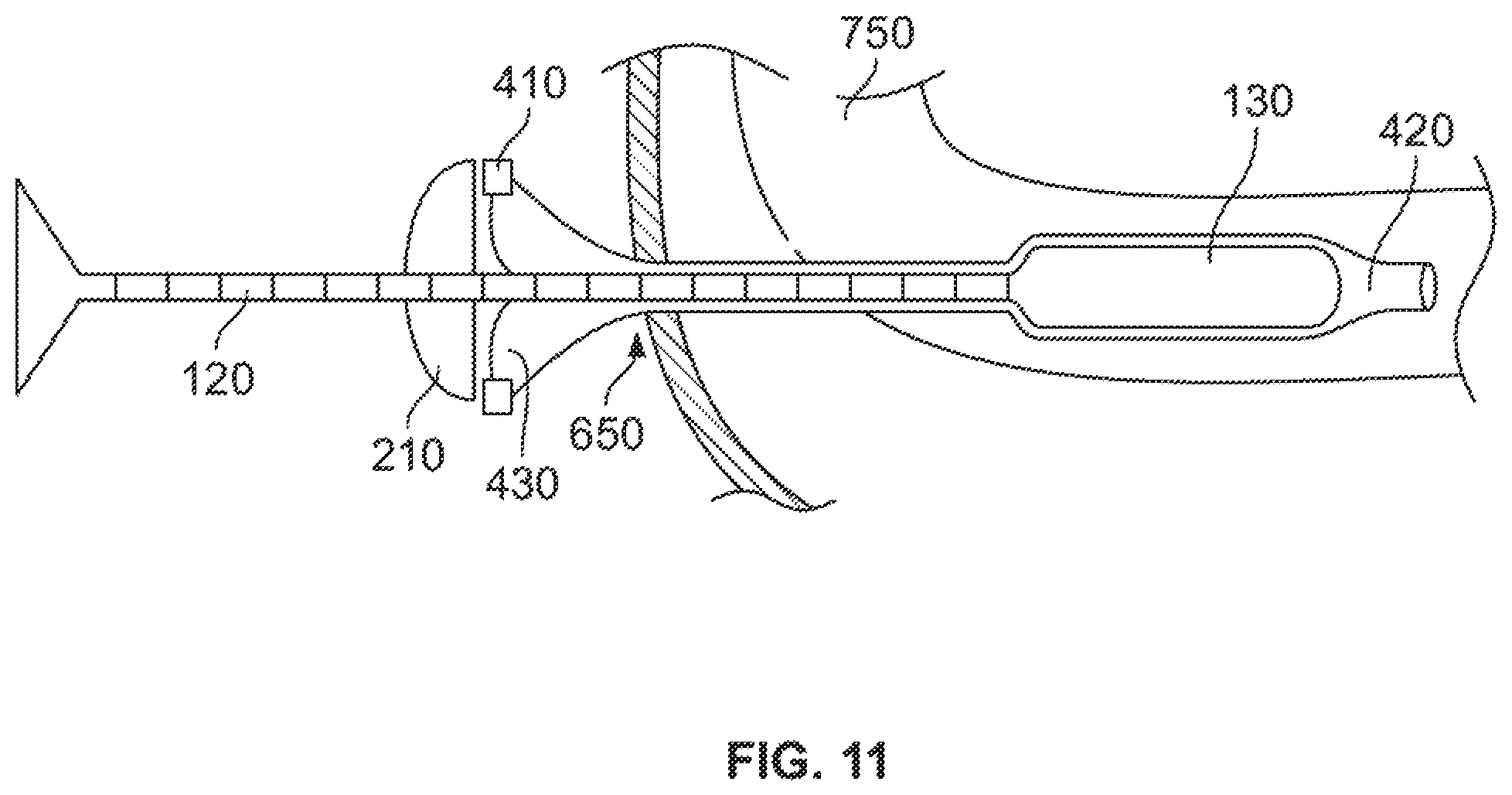 Patent US12496095 Figure 10 – Integrated expandable access for medical device introducer