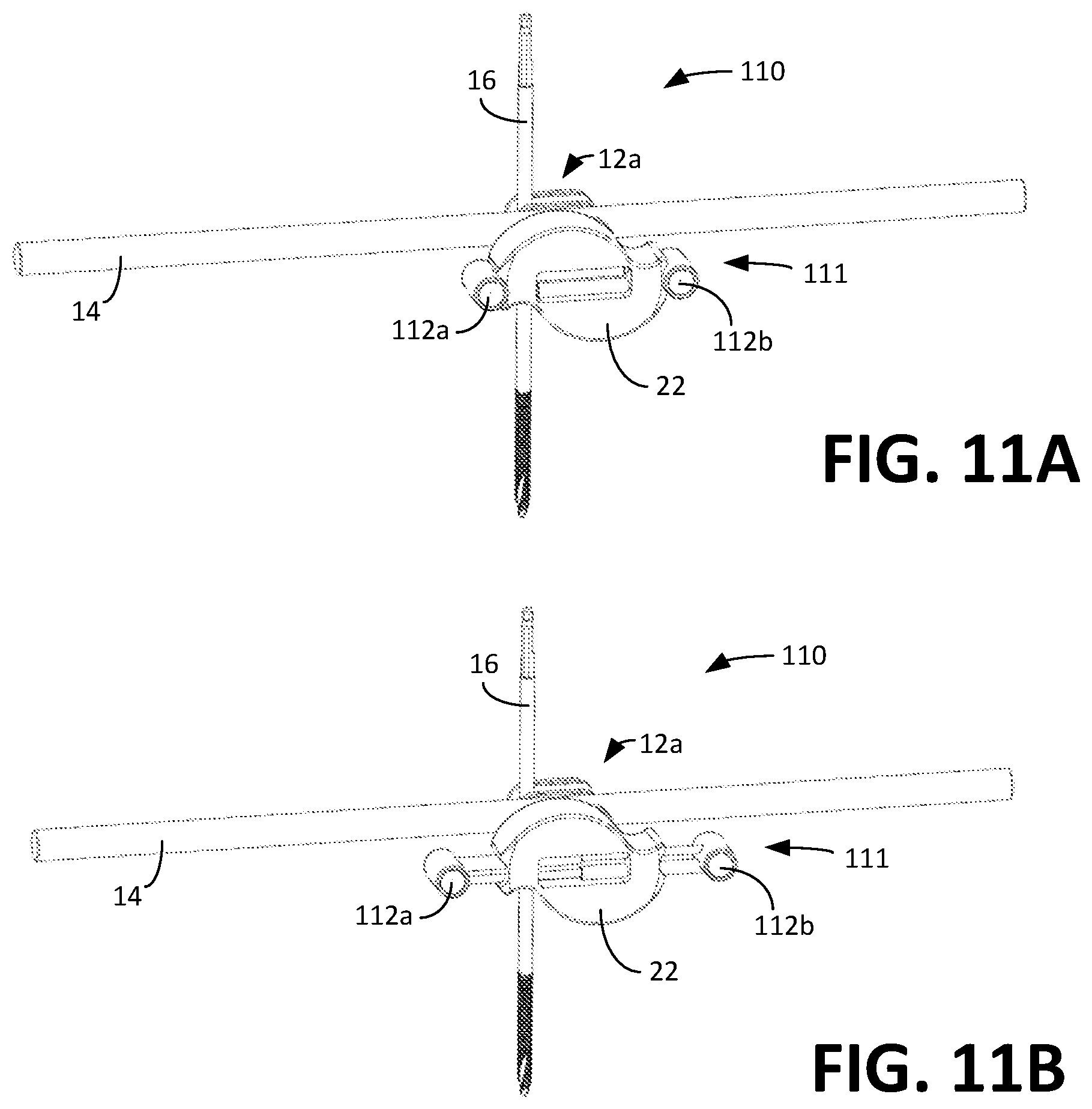 Patent US12496097 Figure 13 – Universal clamp apparatus for bone fixation device
