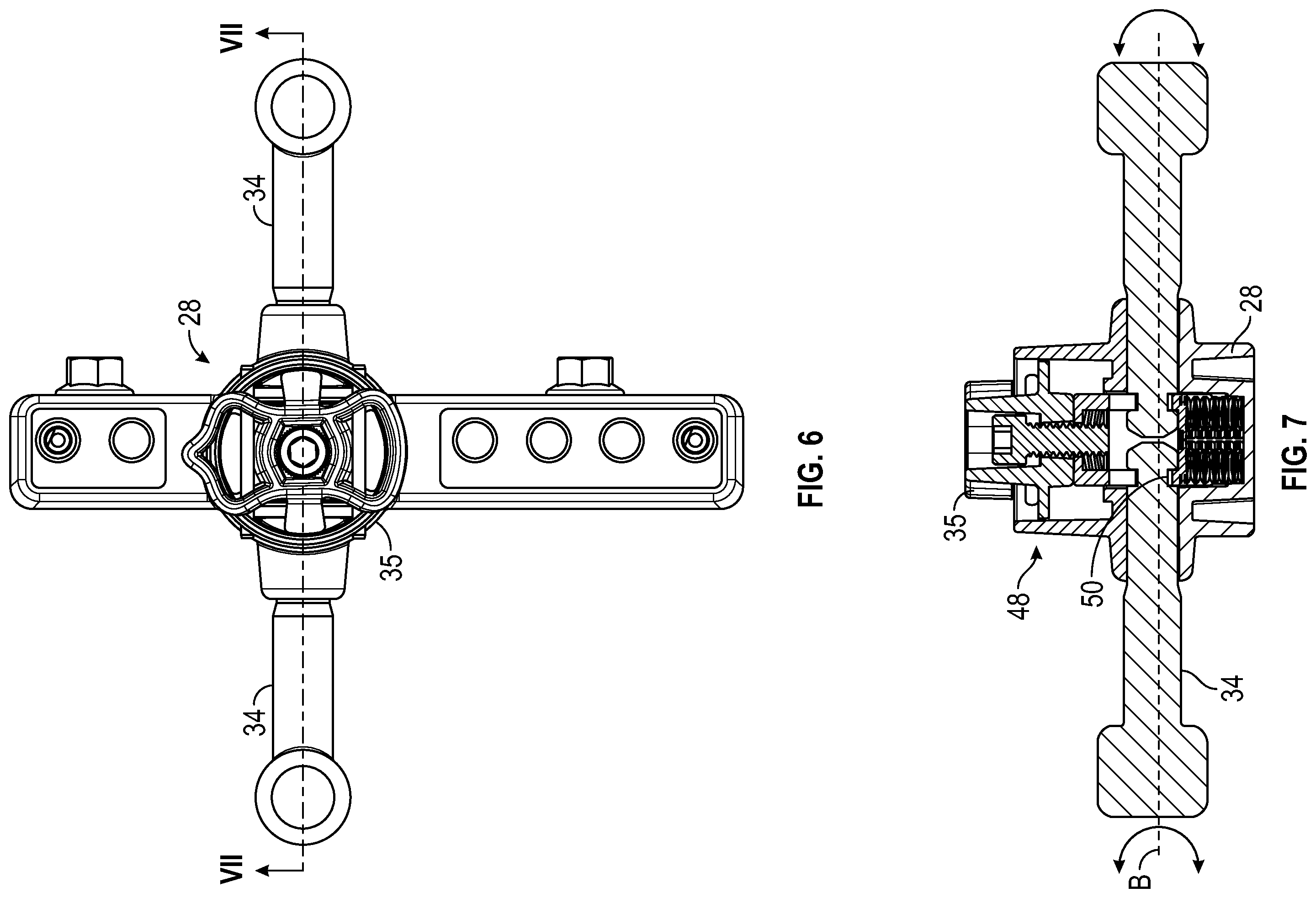 Patent US12496098 Figure 7 – Bone fixator with removable portion
