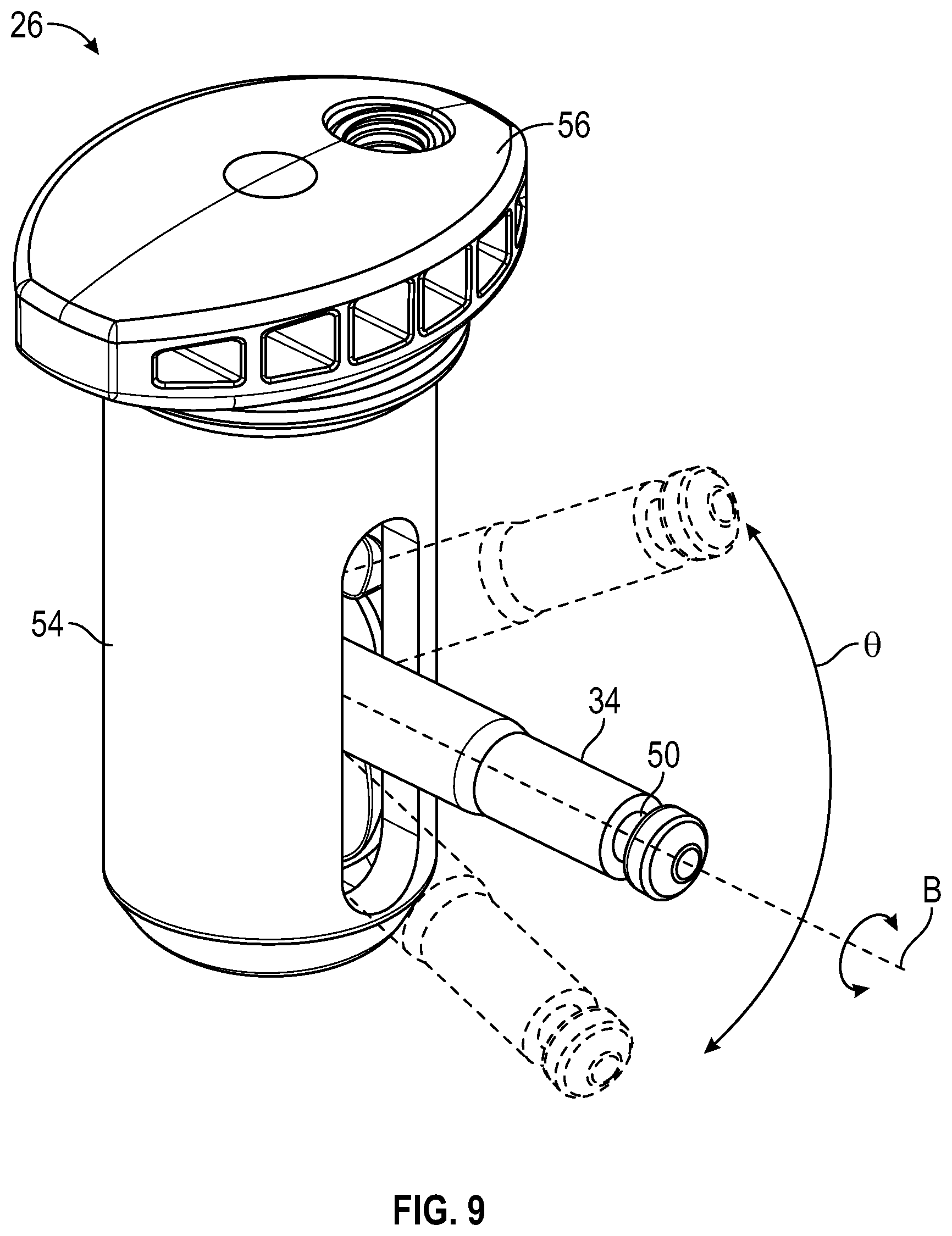 Patent US12496098 Figure 9 – Bone fixator with removable portion