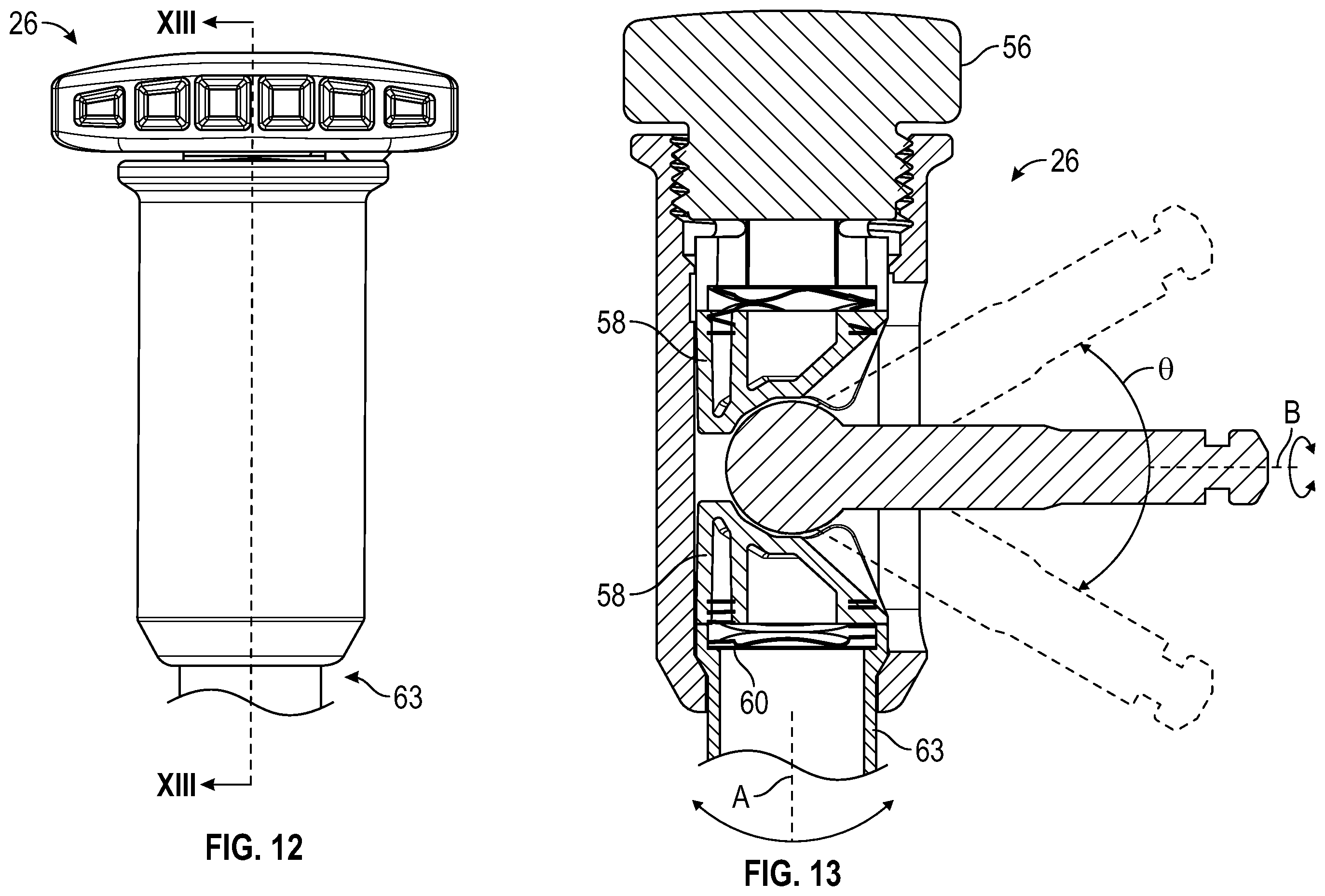 Patent US12496098 Figure 12 – Bone fixator with removable portion