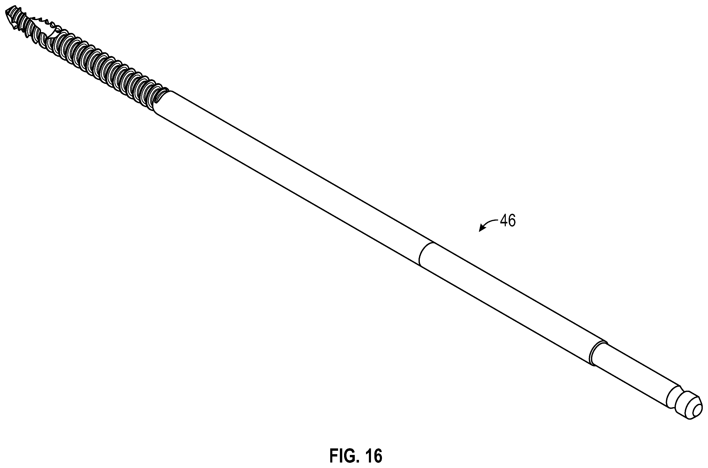 Patent US12496098 Figure 14 – Bone fixator with removable portion
