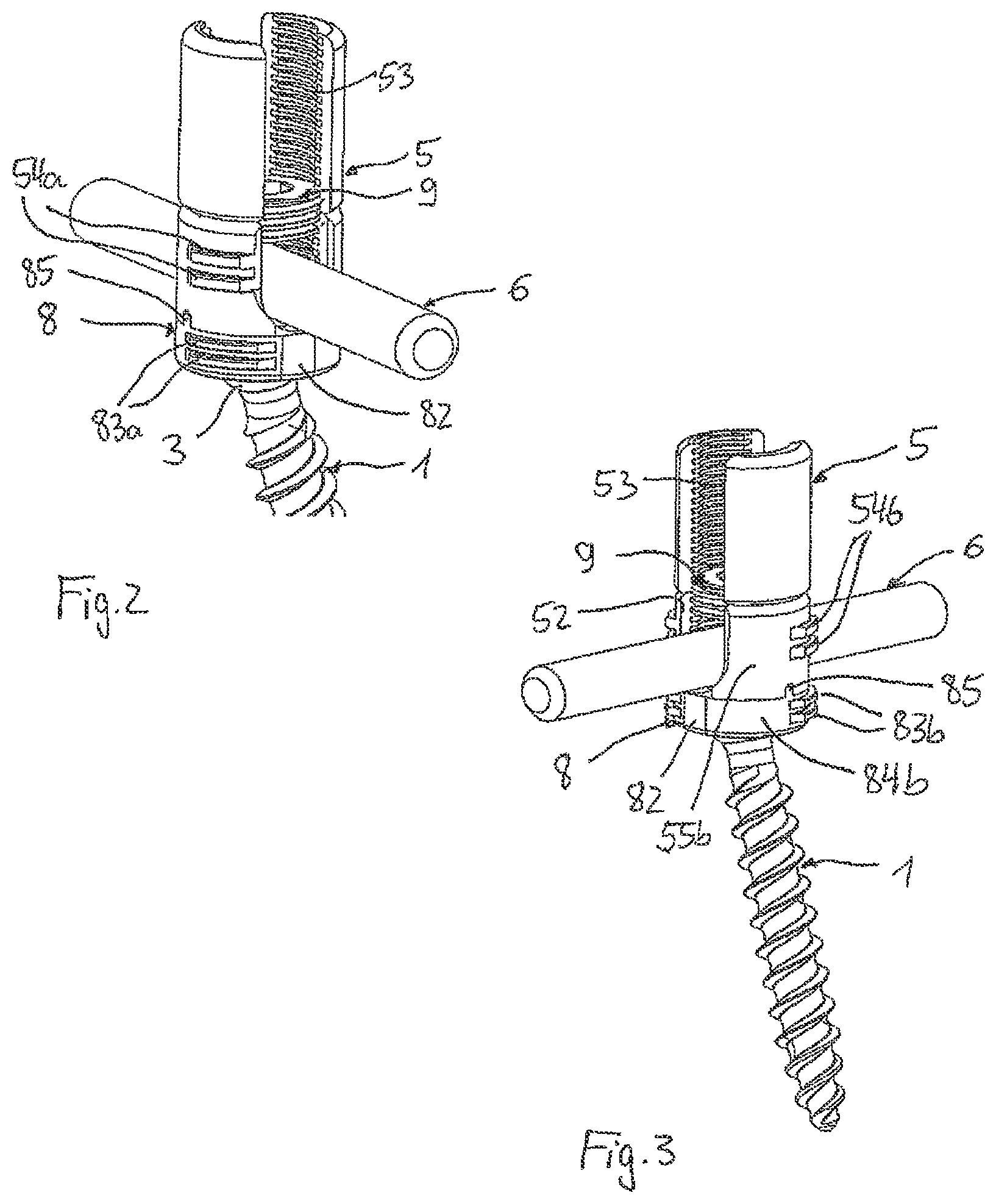 Patent US12496099 Figure 2 – Polyaxial bone anchoring device and system including an instrument and a polyaxial bone anchoring device