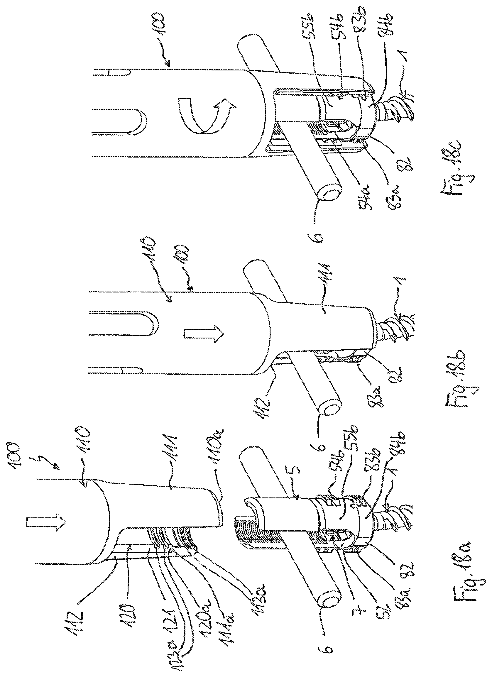 Patent US12496099 Figure 8 – Polyaxial bone anchoring device and system including an instrument and a polyaxial bone anchoring device