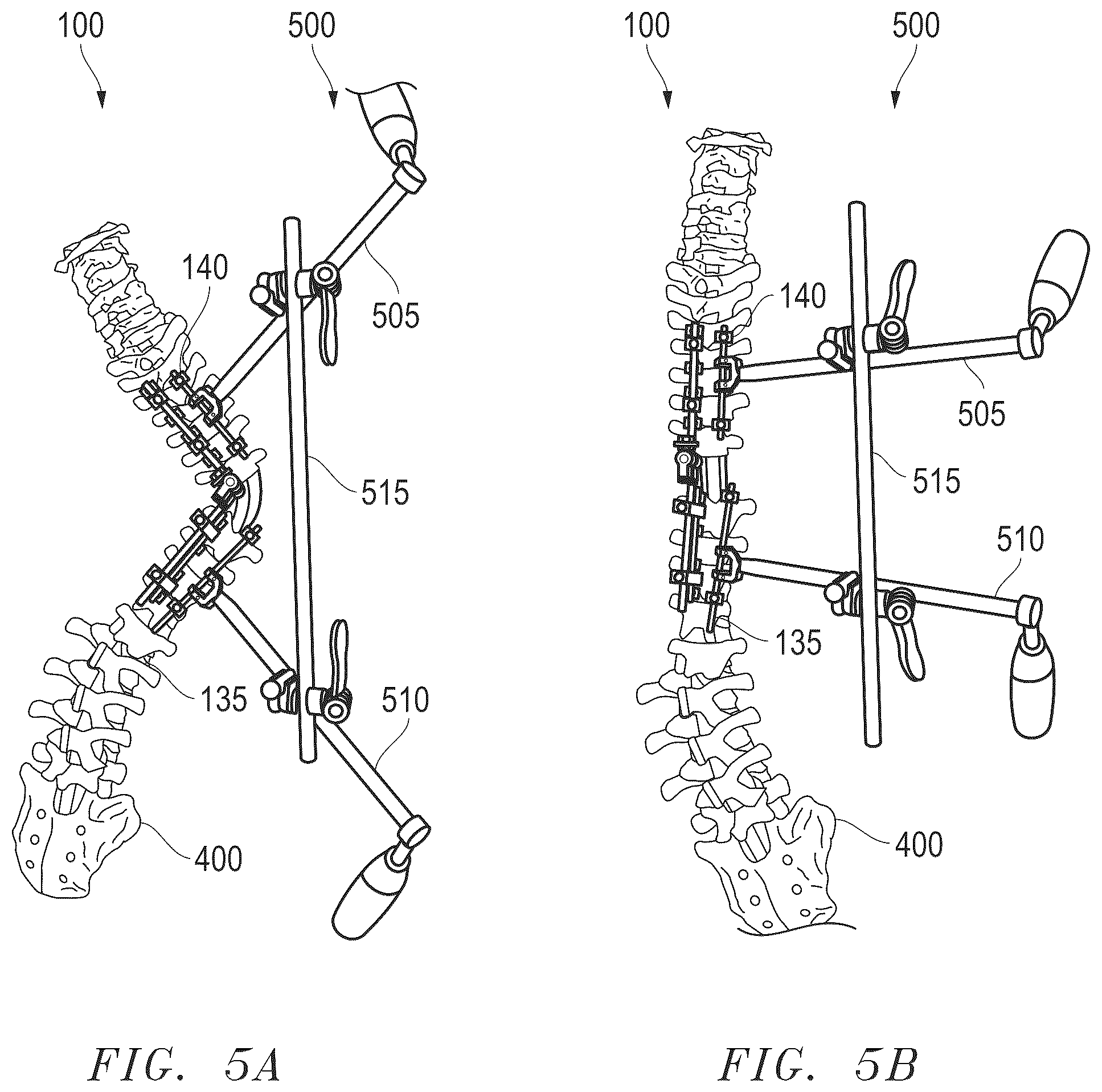 Patent US12496100 Figure 20 – Hinge-link spinal correction device and method