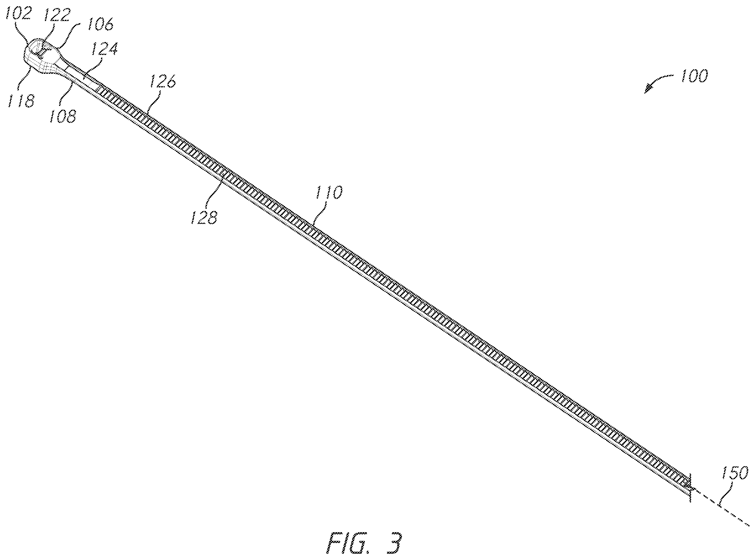 Patent US12496101 Figure 3 – Bone tie and bone tie inserter