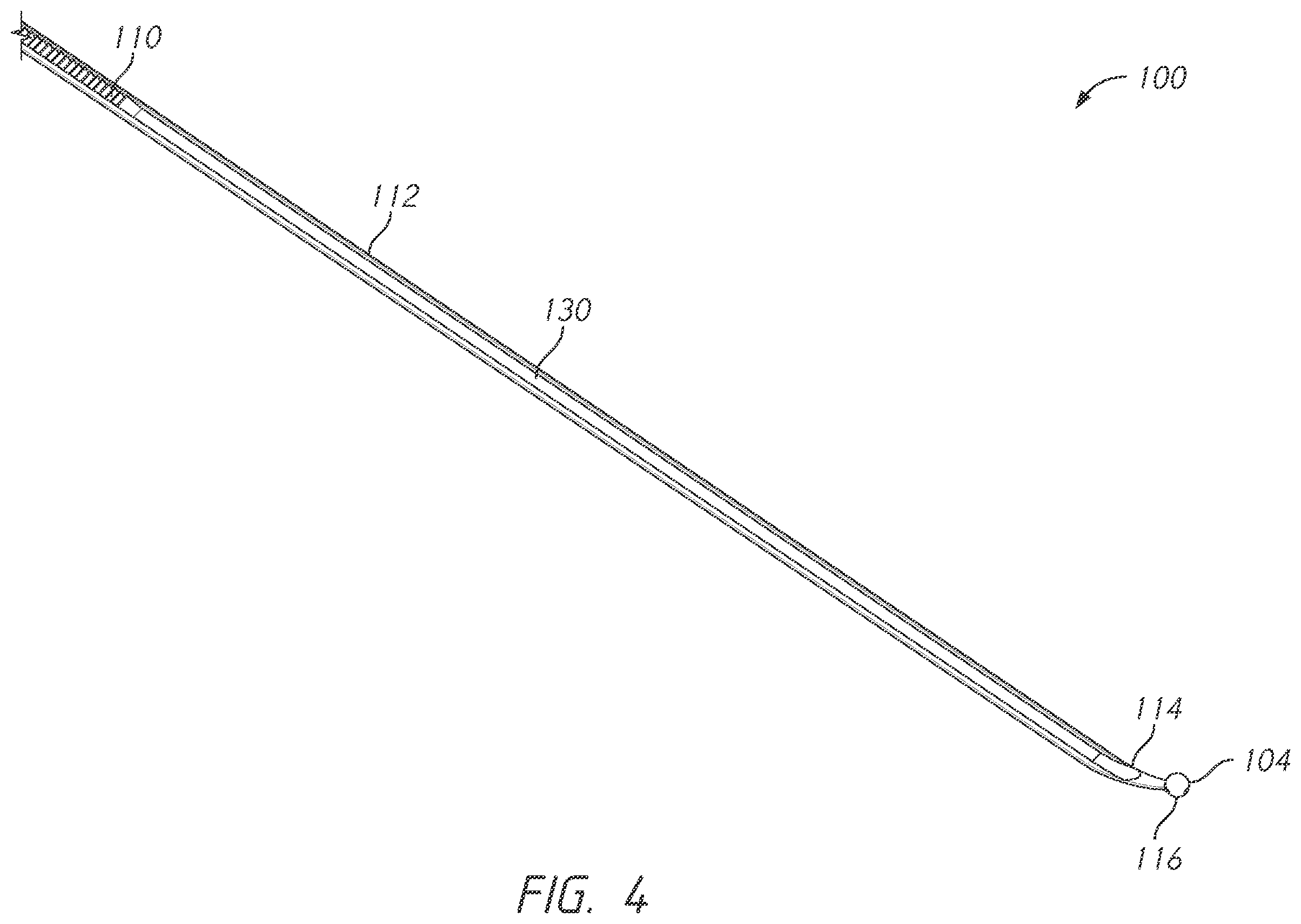 Patent US12496101 Figure 4 – Bone tie and bone tie inserter