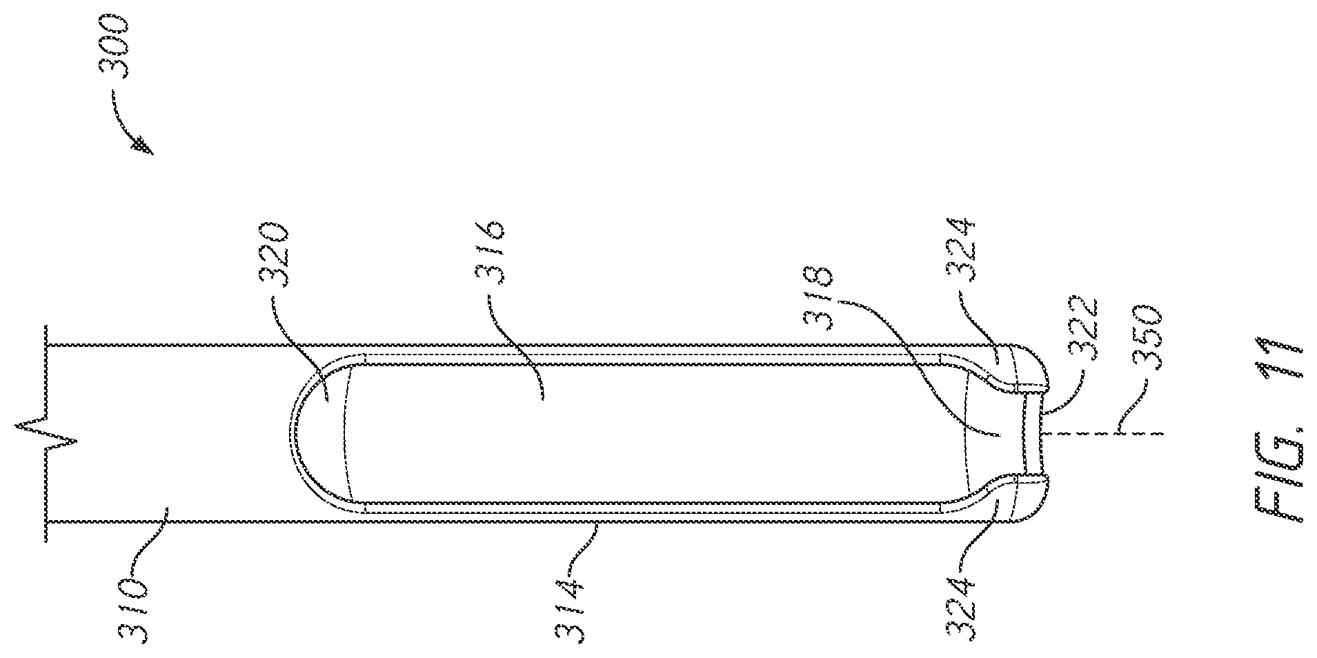 Patent US12496101 Figure 11 – Bone tie and bone tie inserter