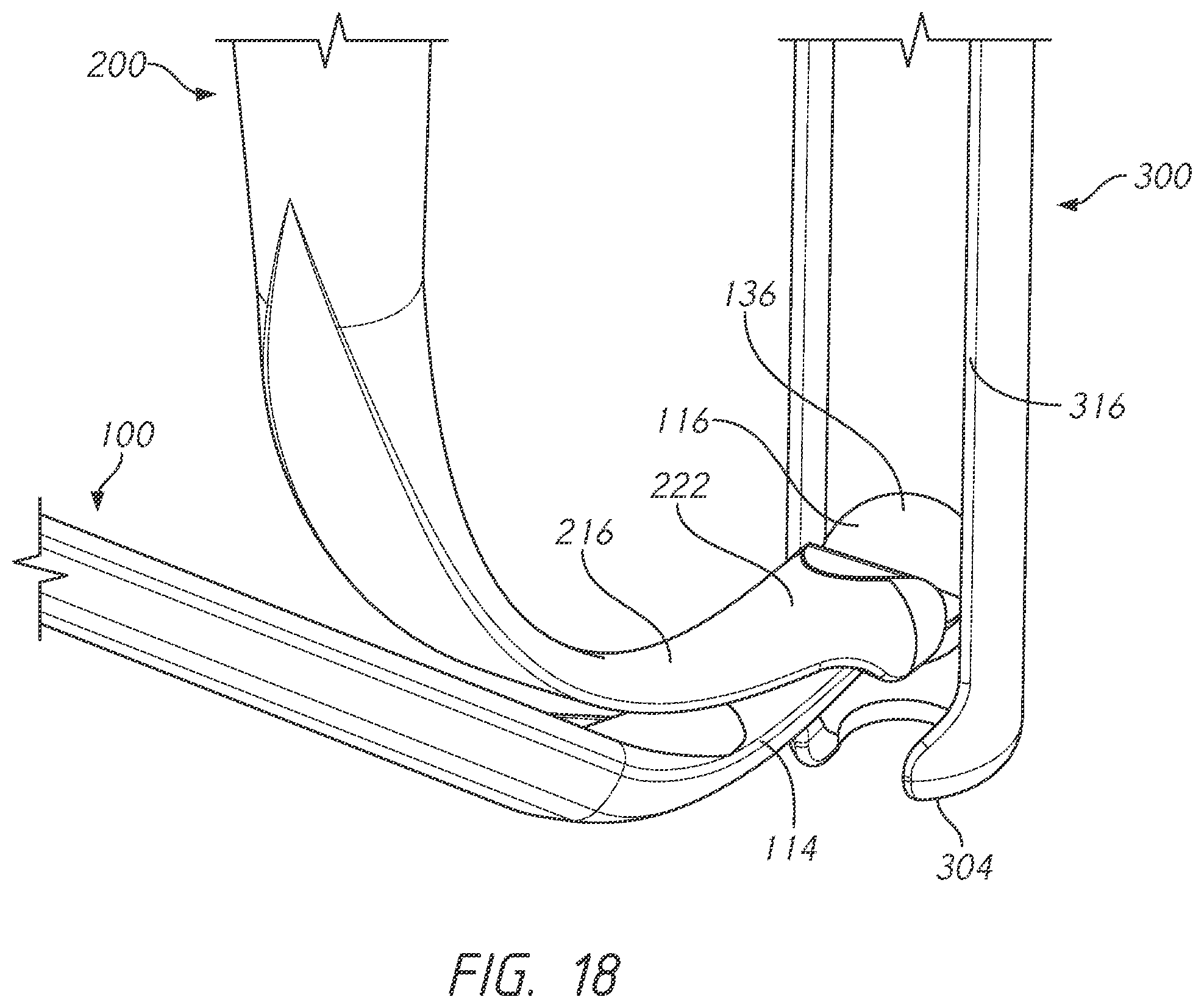 Patent US12496101 Figure 18 – Bone tie and bone tie inserter