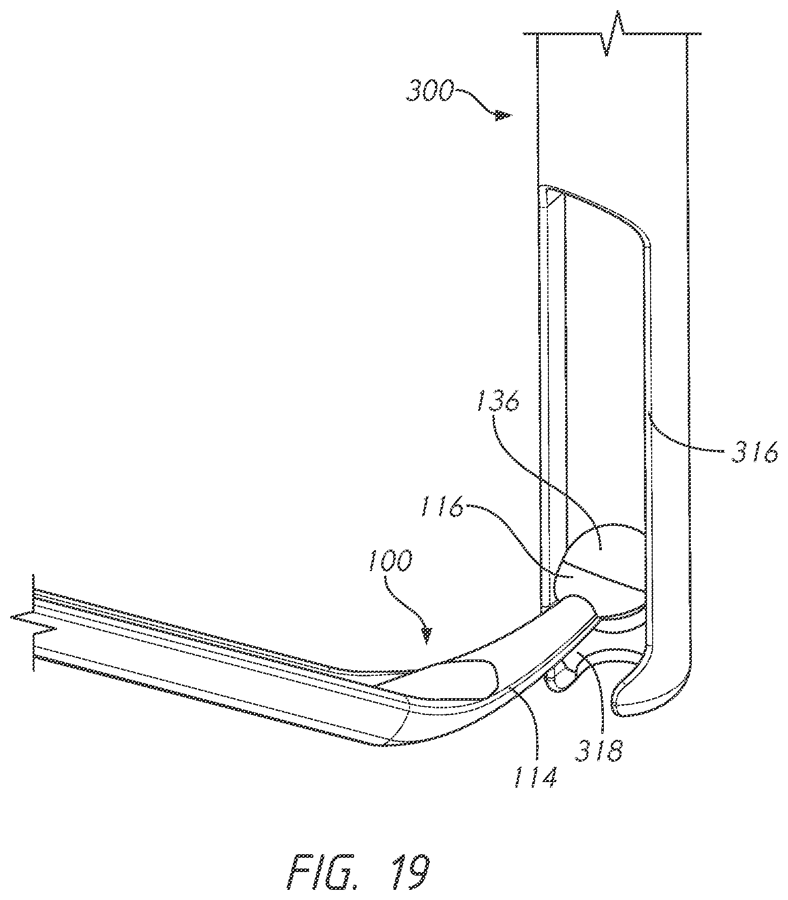 Patent US12496101 Figure 19 – Bone tie and bone tie inserter