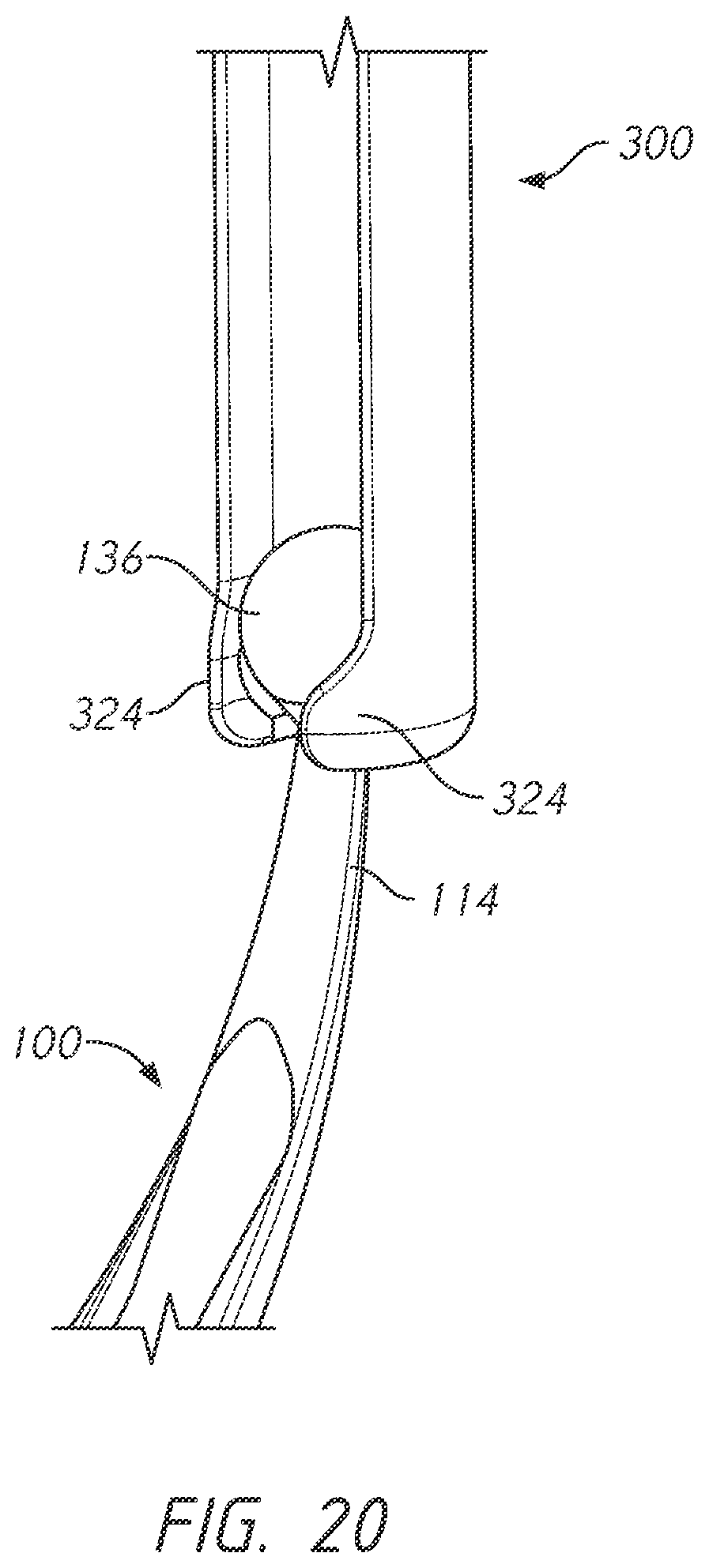 Patent US12496101 Figure 20 – Bone tie and bone tie inserter