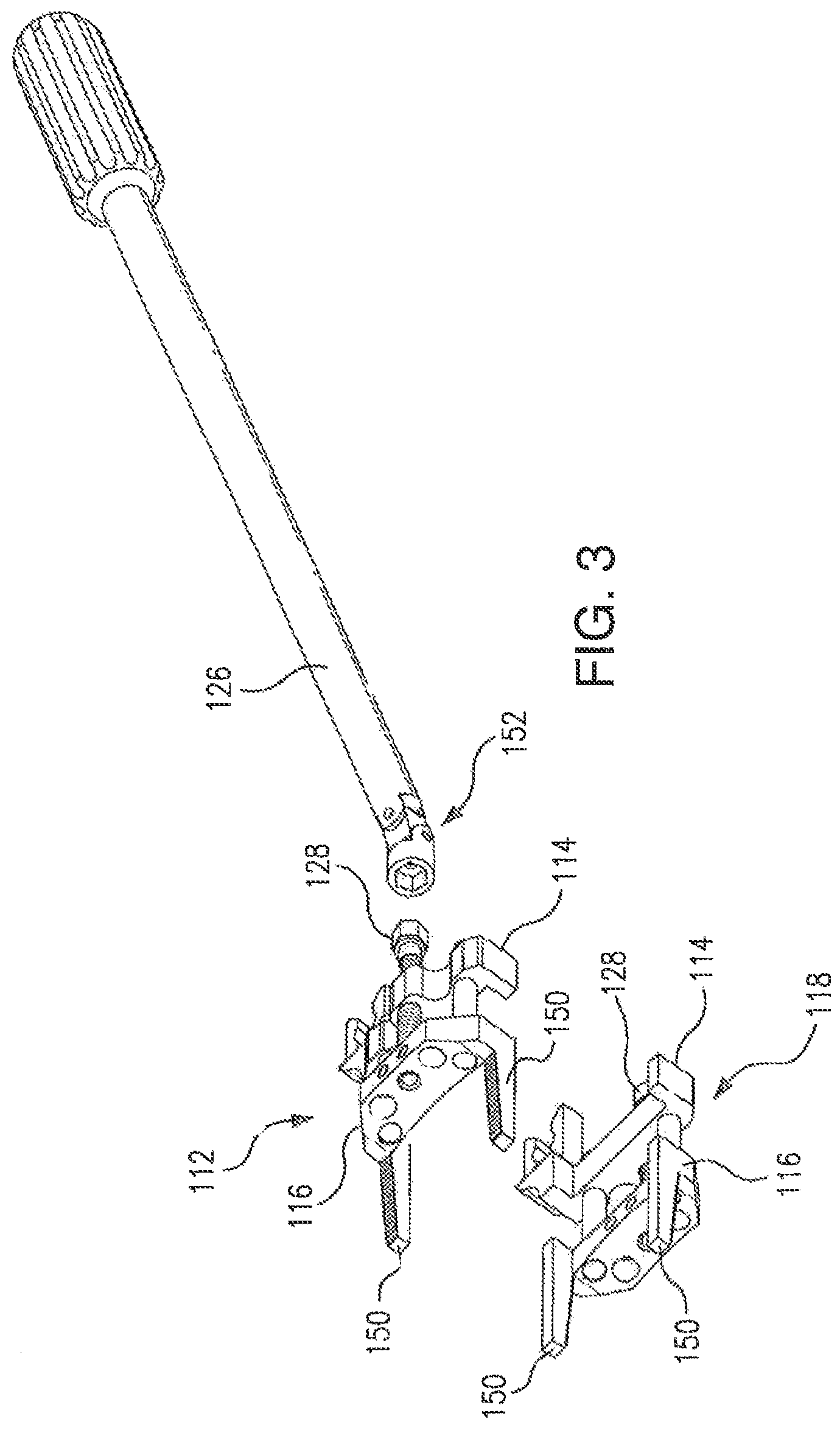 Patent US12496102 Figure 2 – Translational instrumentation for spondylolisthesis and scoliosis reduction