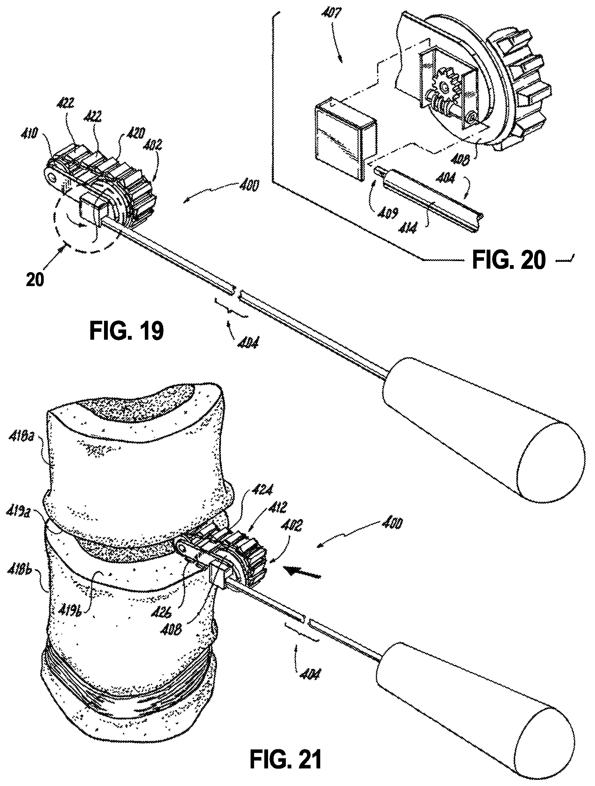 Patent US12496102 Figure 13 – Translational instrumentation for spondylolisthesis and scoliosis reduction