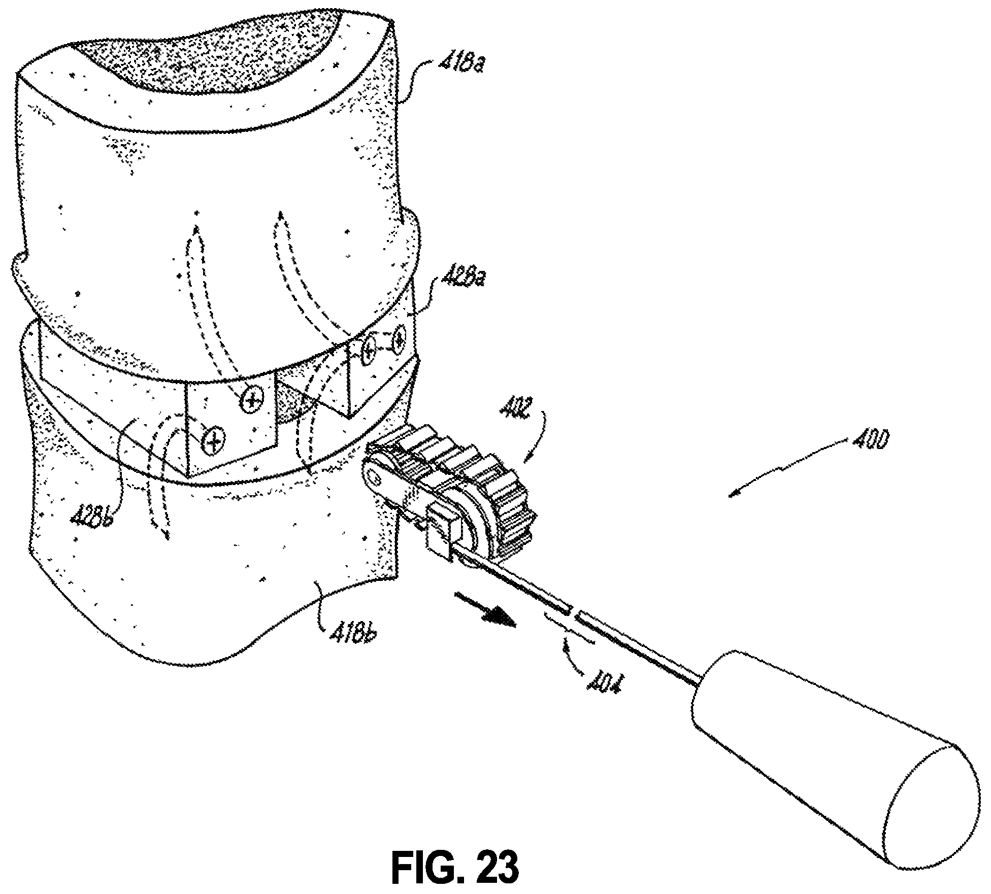 Patent US12496102 Figure 15 – Translational instrumentation for spondylolisthesis and scoliosis reduction