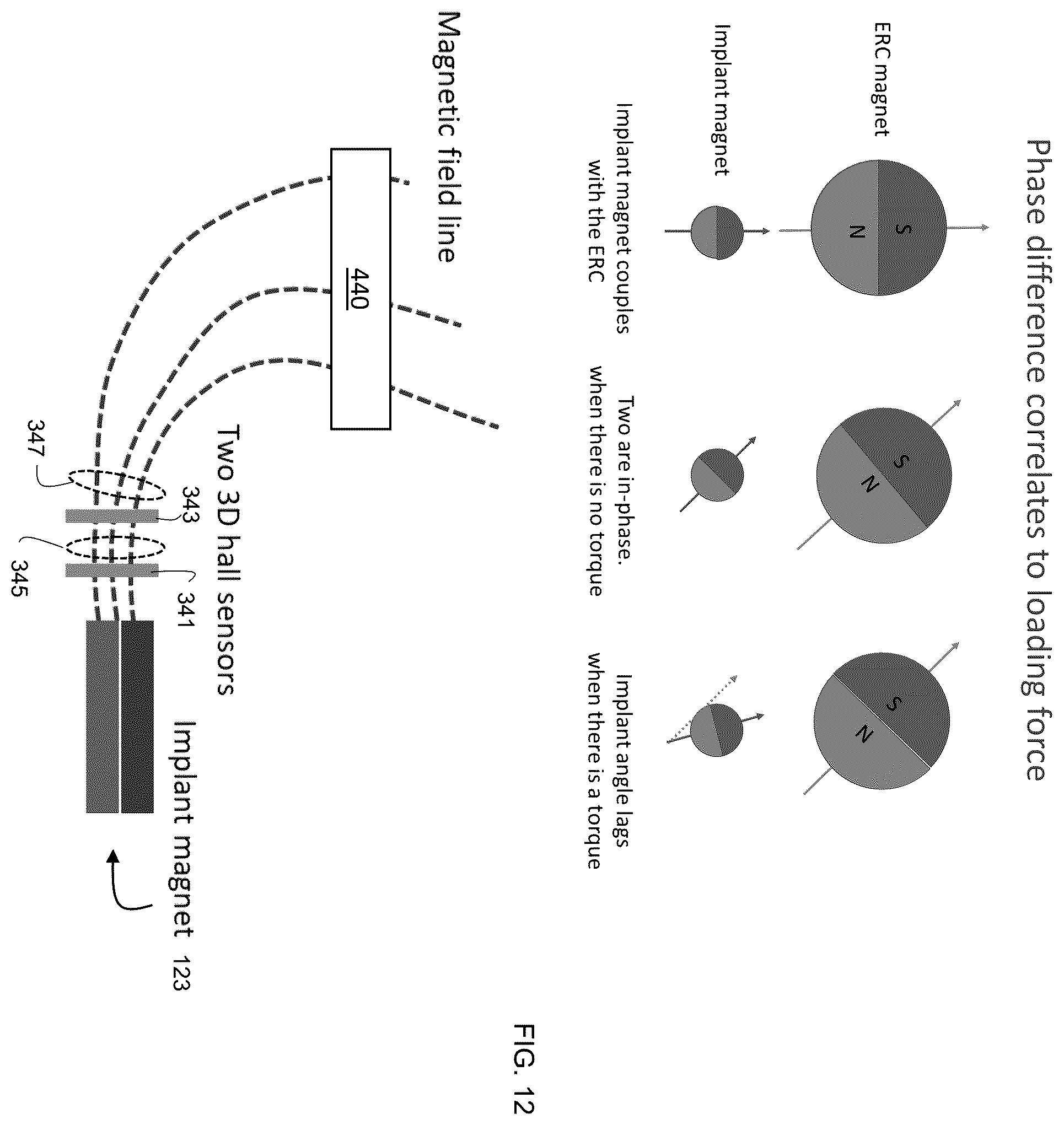 Patent US12496103 Figure 7 – Adjustable implant, system and methods