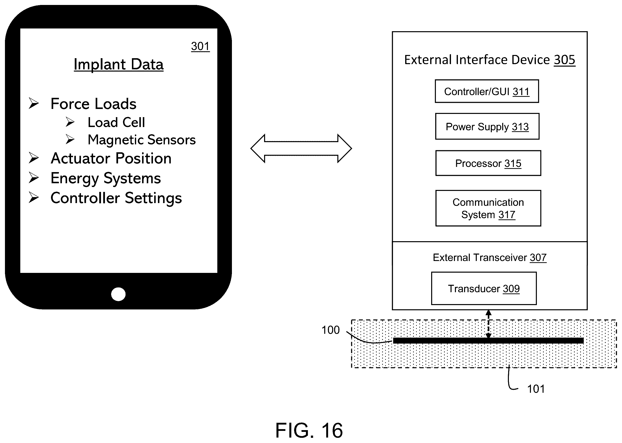 Patent US12496103 Figure 10 – Adjustable implant, system and methods