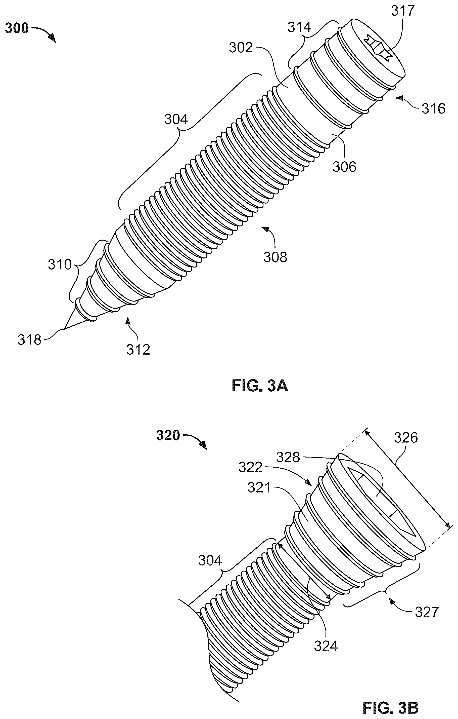Patent US12496104 Figure 3 – Intramedullary bone fixation devices, systems, and methods