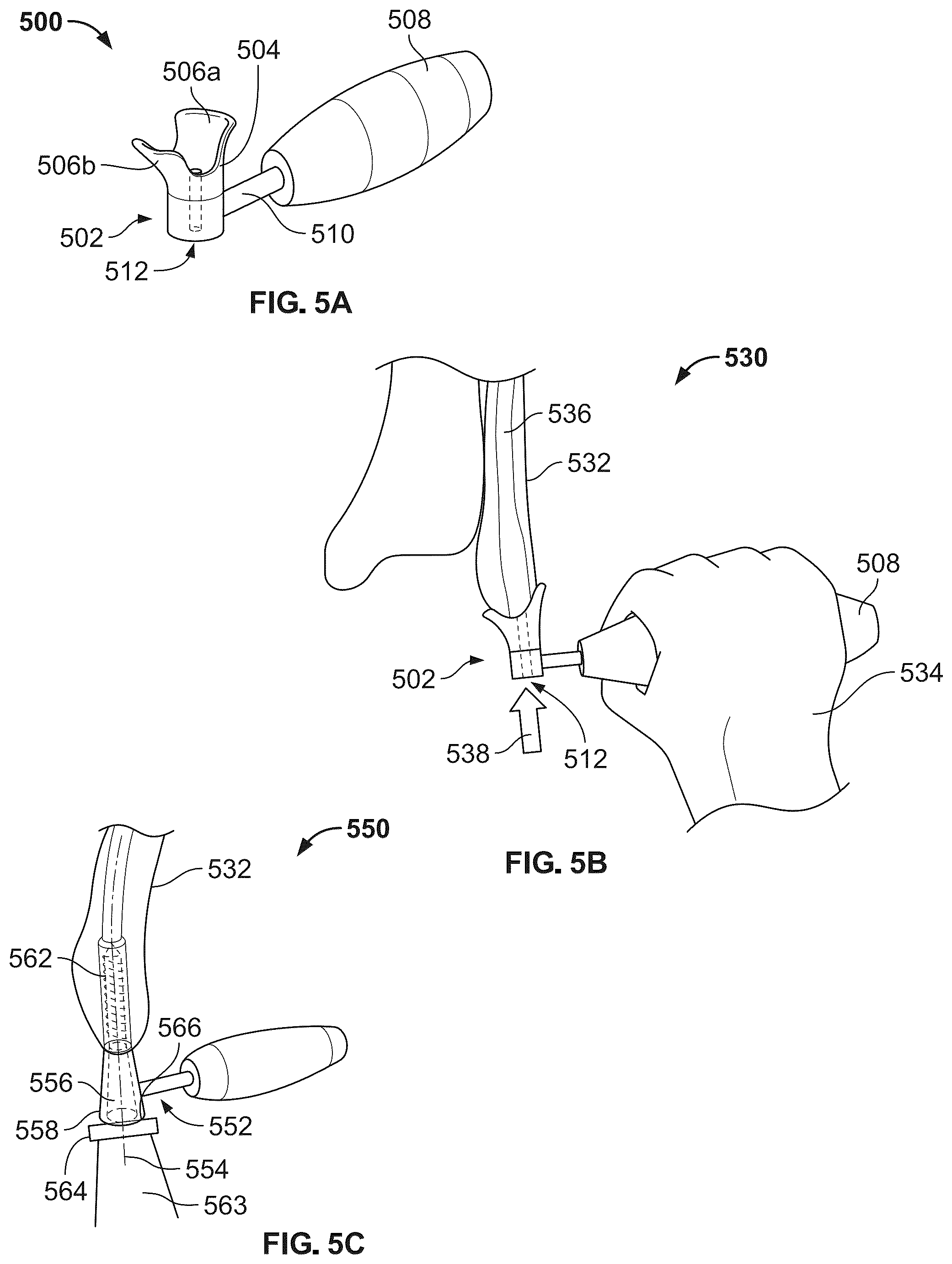Patent US12496104 Figure 5 – Intramedullary bone fixation devices, systems, and methods