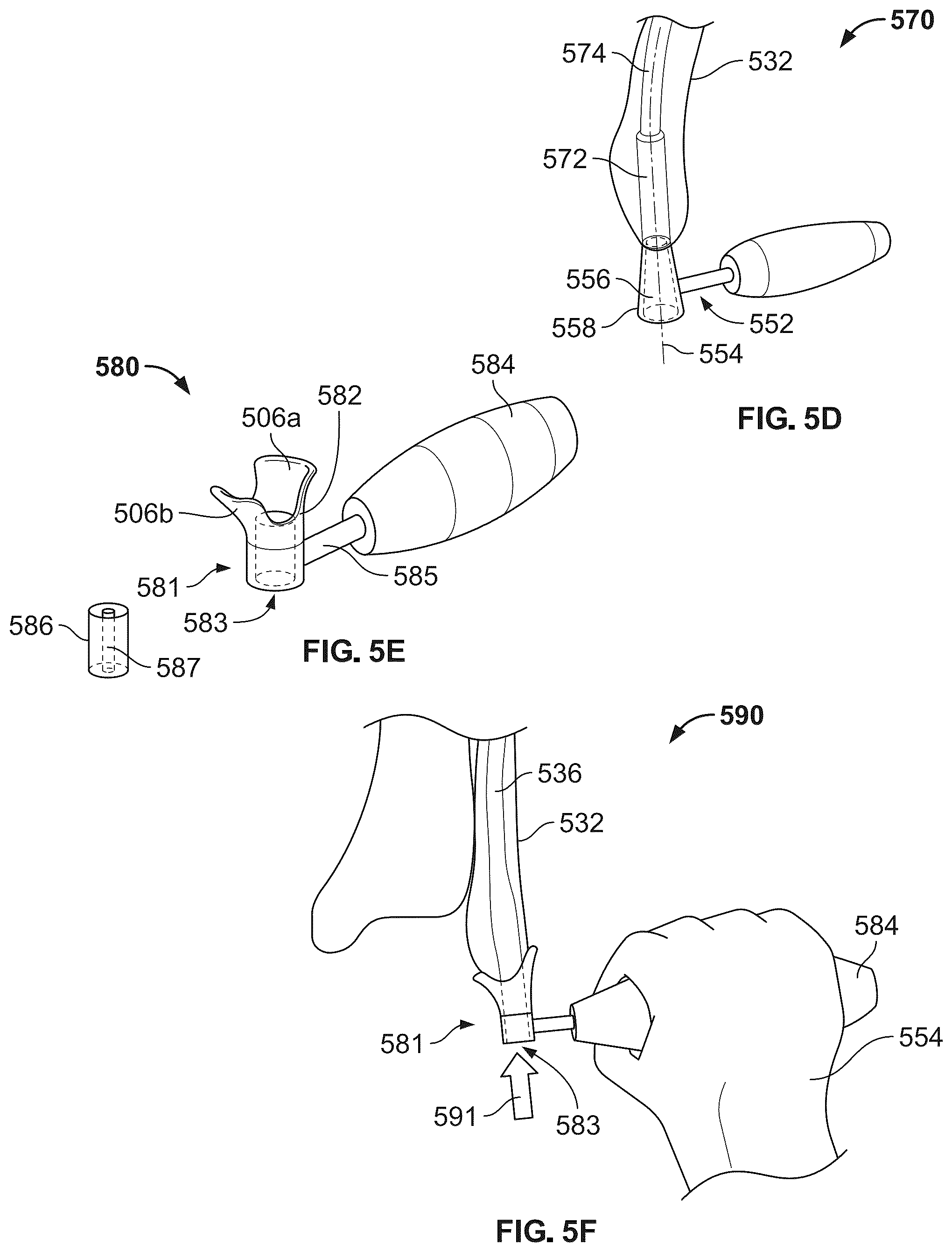 Patent US12496104 Figure 6 – Intramedullary bone fixation devices, systems, and methods