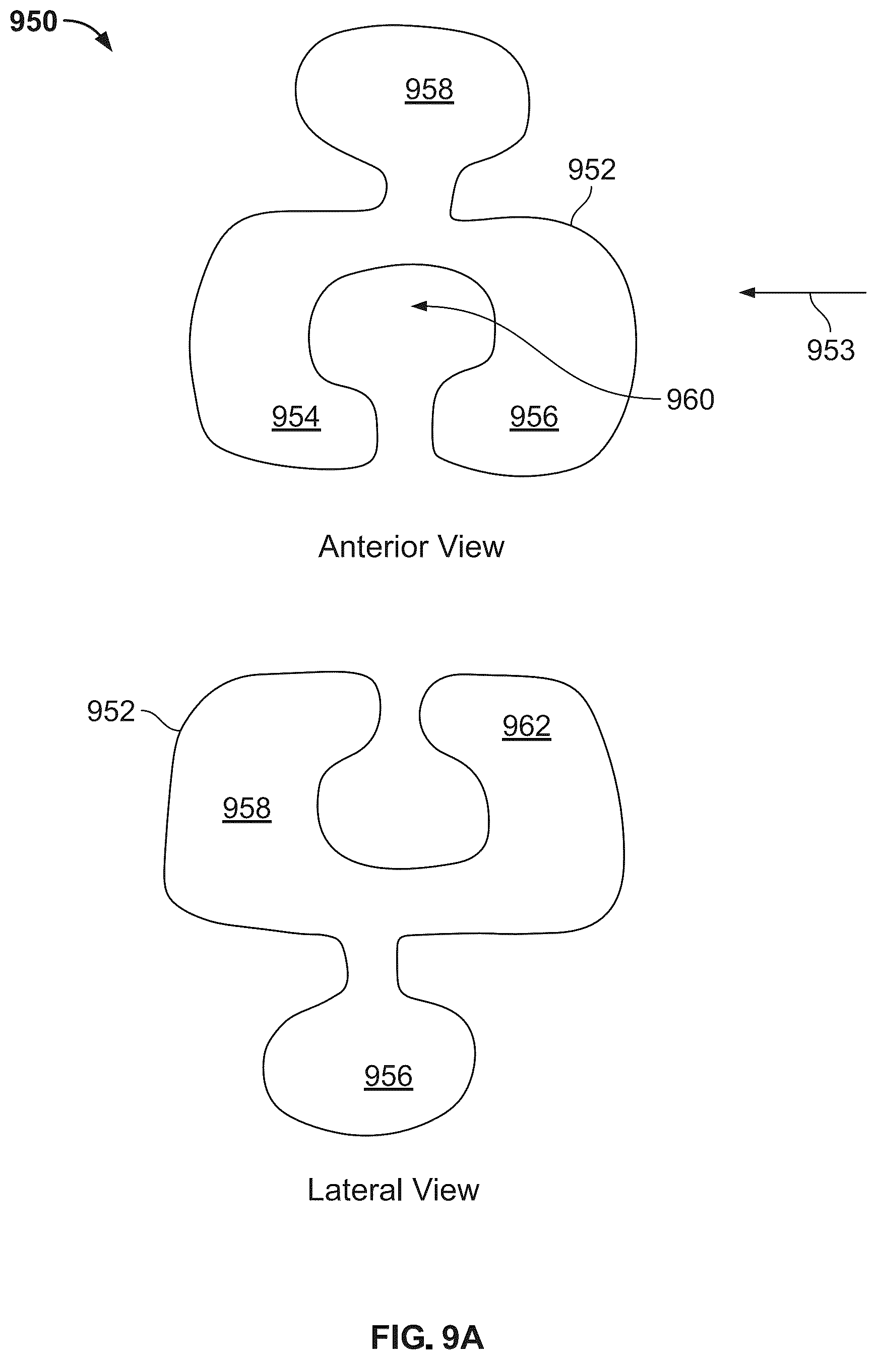 Patent US12496104 Figure 13 – Intramedullary bone fixation devices, systems, and methods