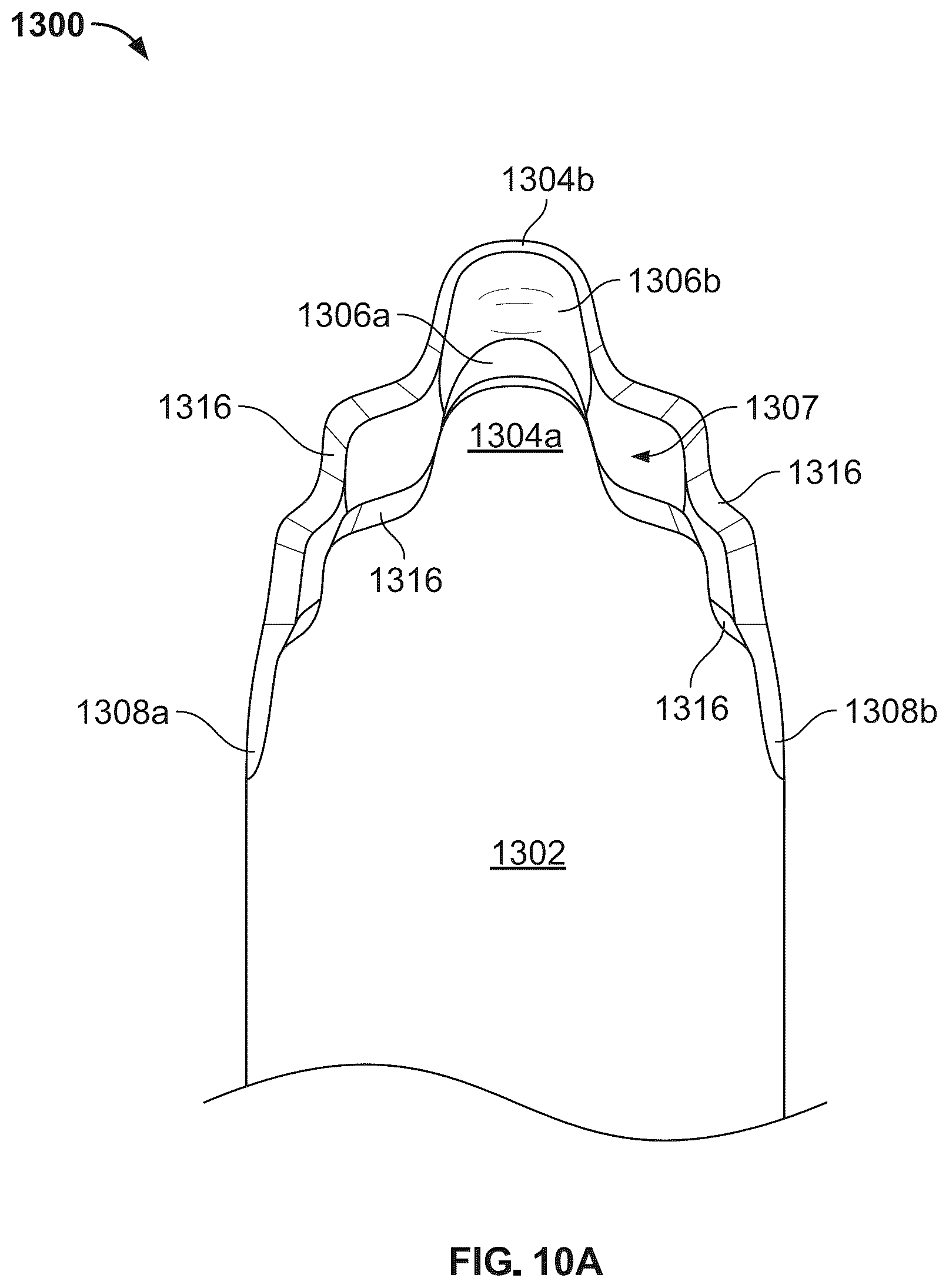Patent US12496104 Figure 16 – Intramedullary bone fixation devices, systems, and methods