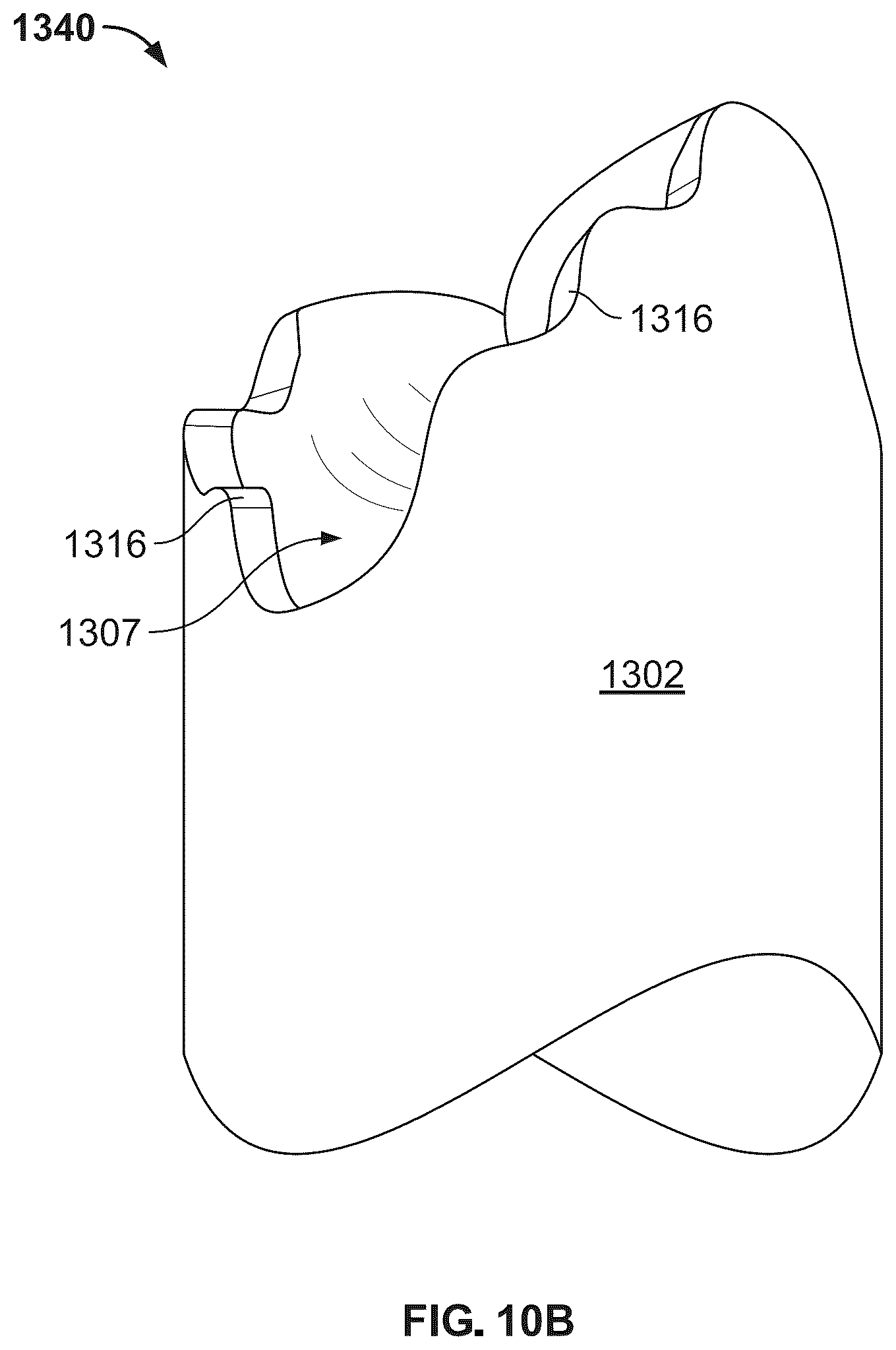 Patent US12496104 Figure 17 – Intramedullary bone fixation devices, systems, and methods