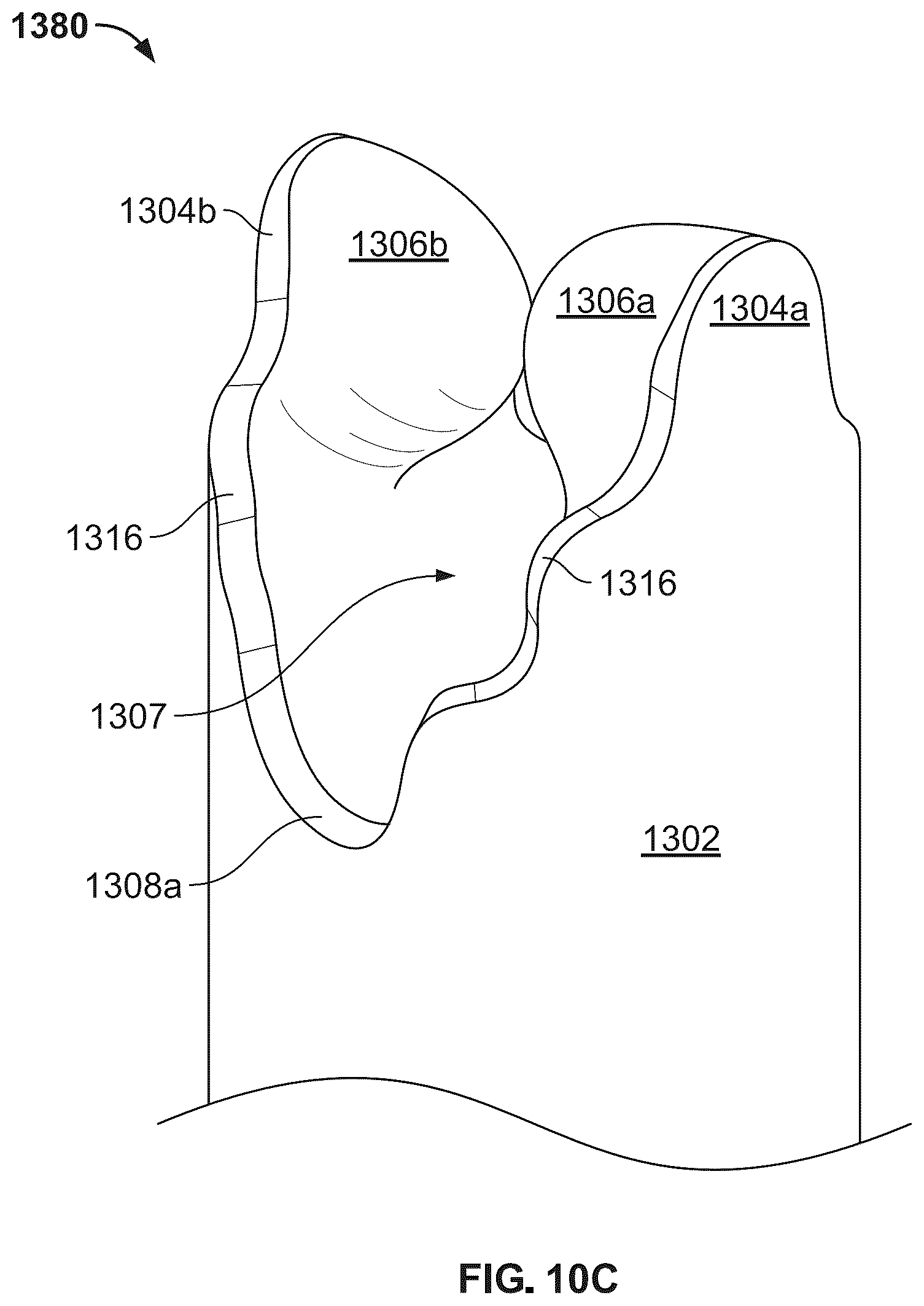 Patent US12496104 Figure 18 – Intramedullary bone fixation devices, systems, and methods