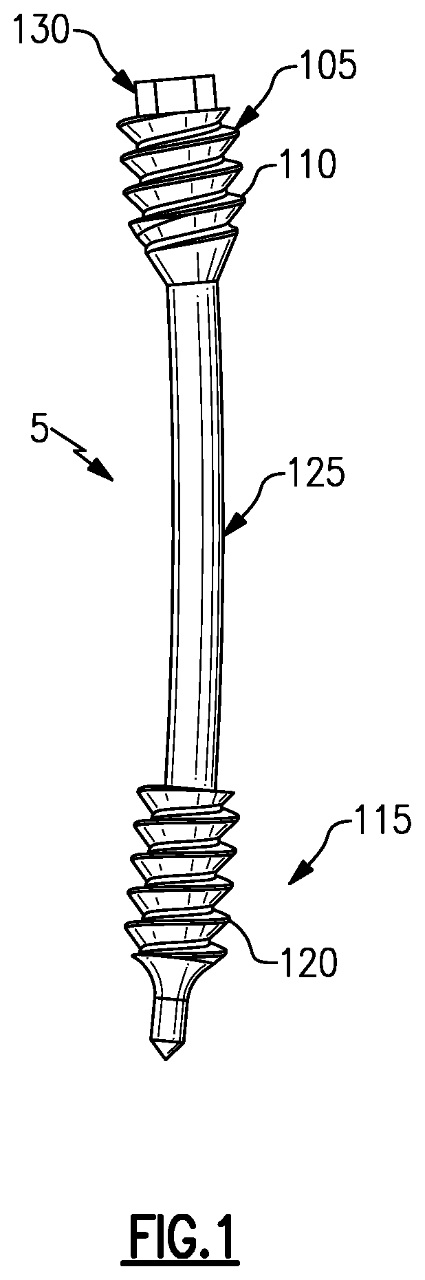 Patent US12496105 Figure 1 – Devices for generating and applying compression within a body