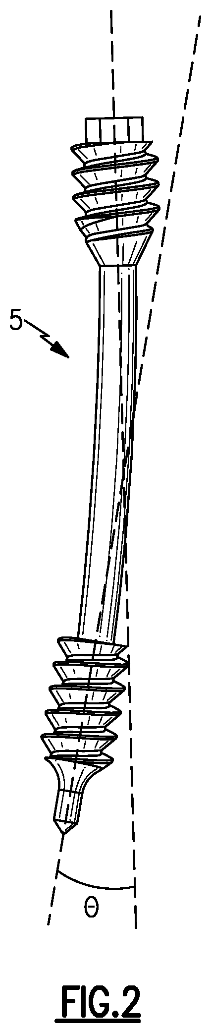 Patent US12496105 Figure 2 – Devices for generating and applying compression within a body