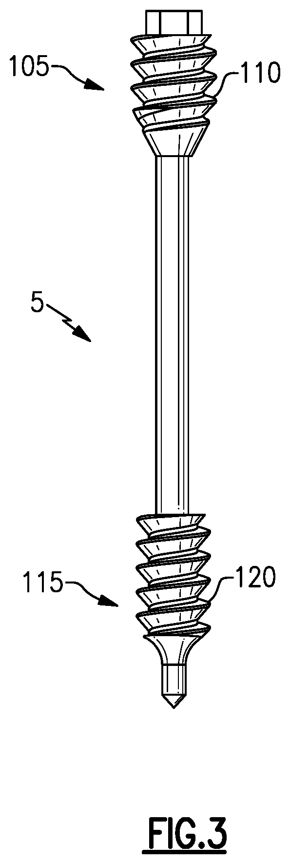 Patent US12496105 Figure 3 – Devices for generating and applying compression within a body