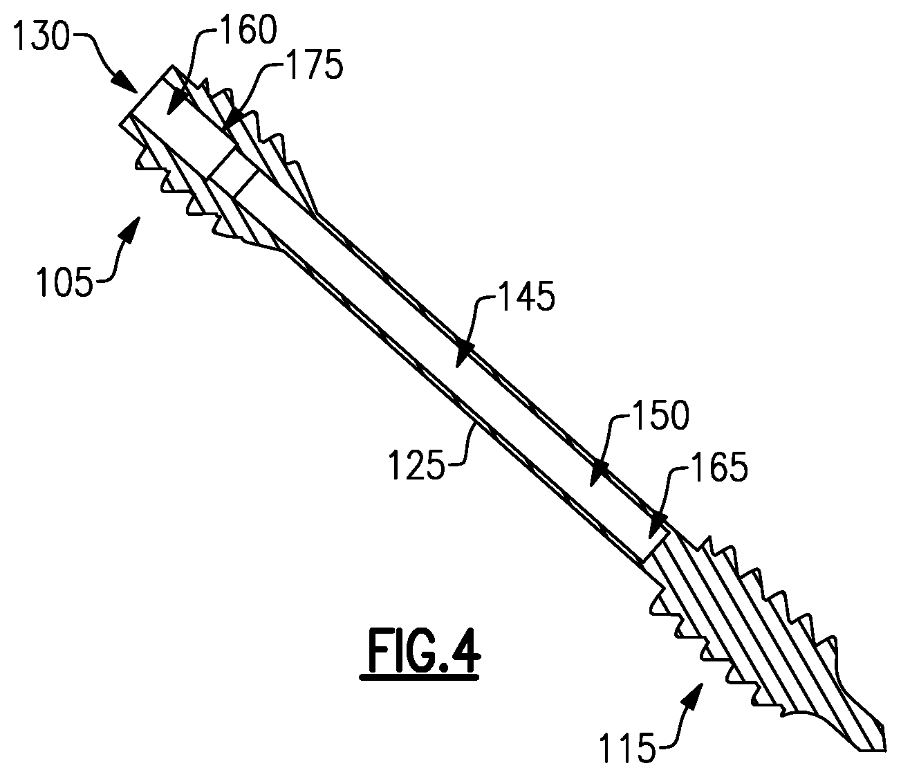 Patent US12496105 Figure 4 – Devices for generating and applying compression within a body