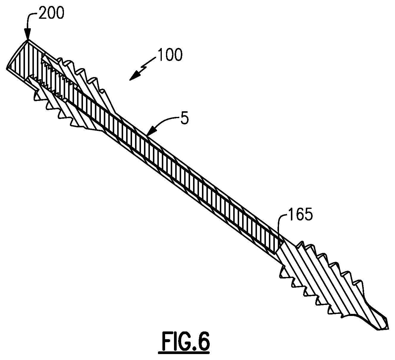 Patent US12496105 Figure 6 – Devices for generating and applying compression within a body